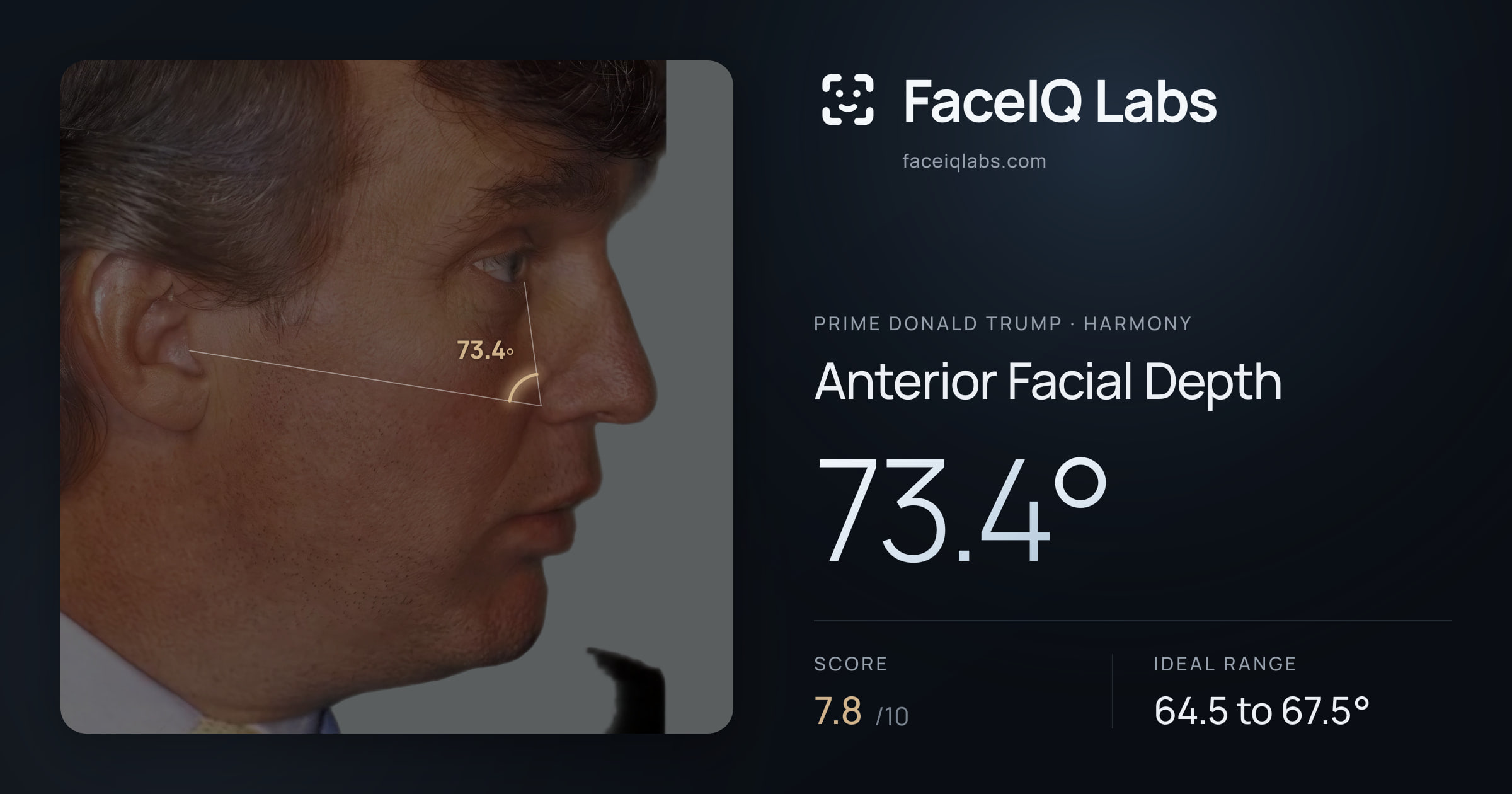 Prime Donald Trump Anterior Facial Depth: 73.4°, drawn on the photo