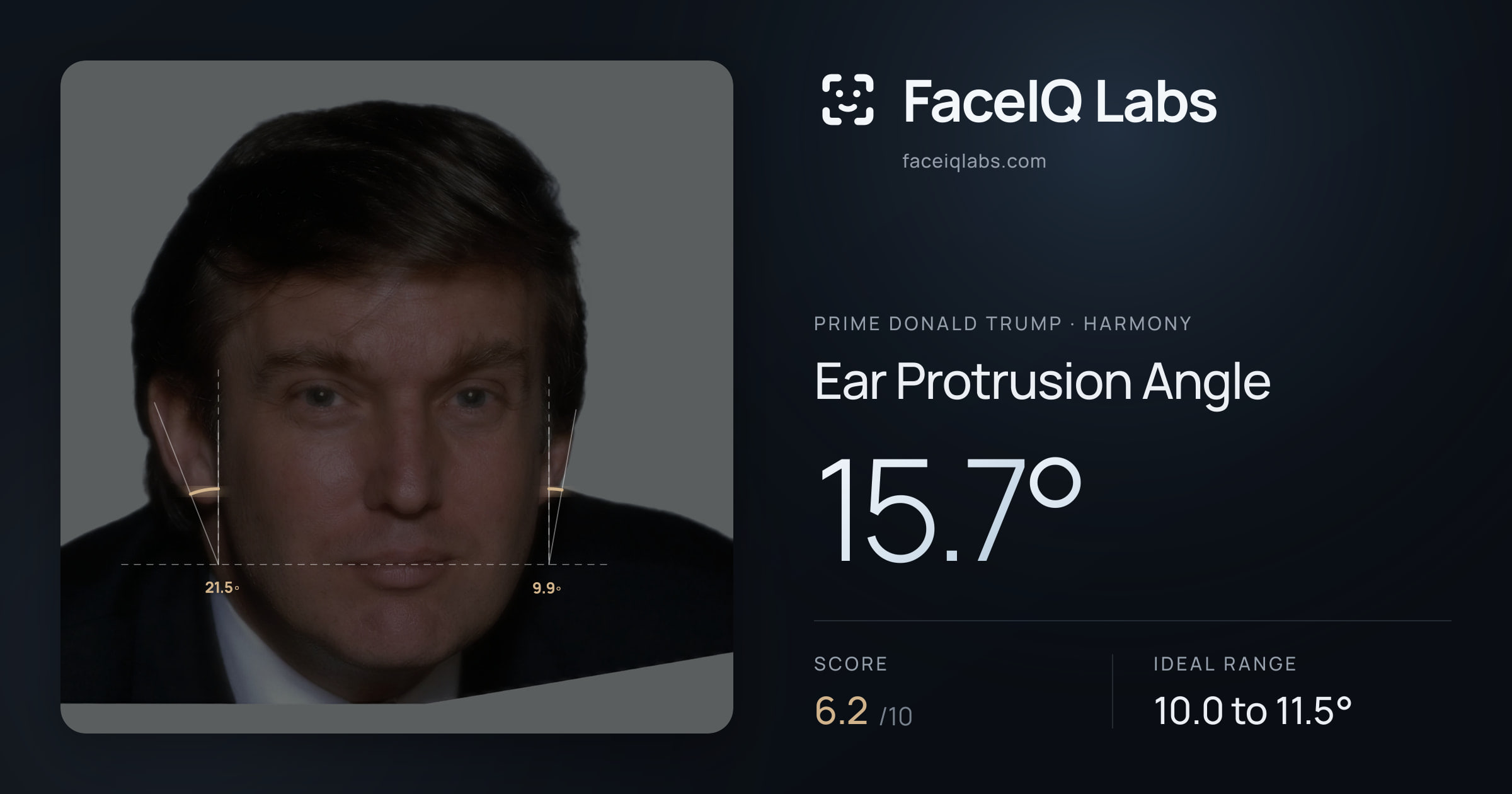 Prime Donald Trump Ear Protrusion Angle: 15.7°, drawn on the photo