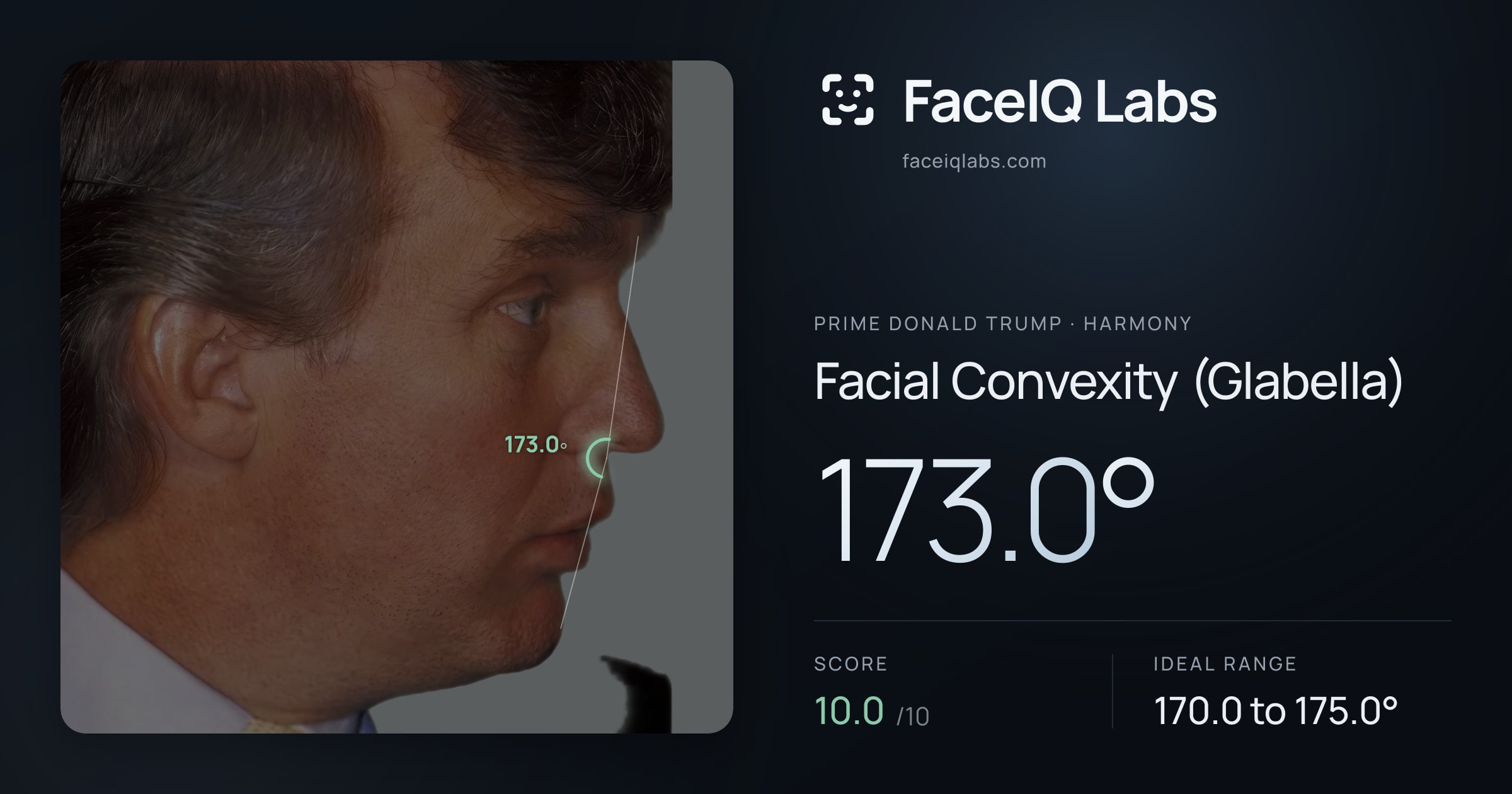 Prime Donald Trump Facial Convexity (Glabella): 173.0°, drawn on the photo