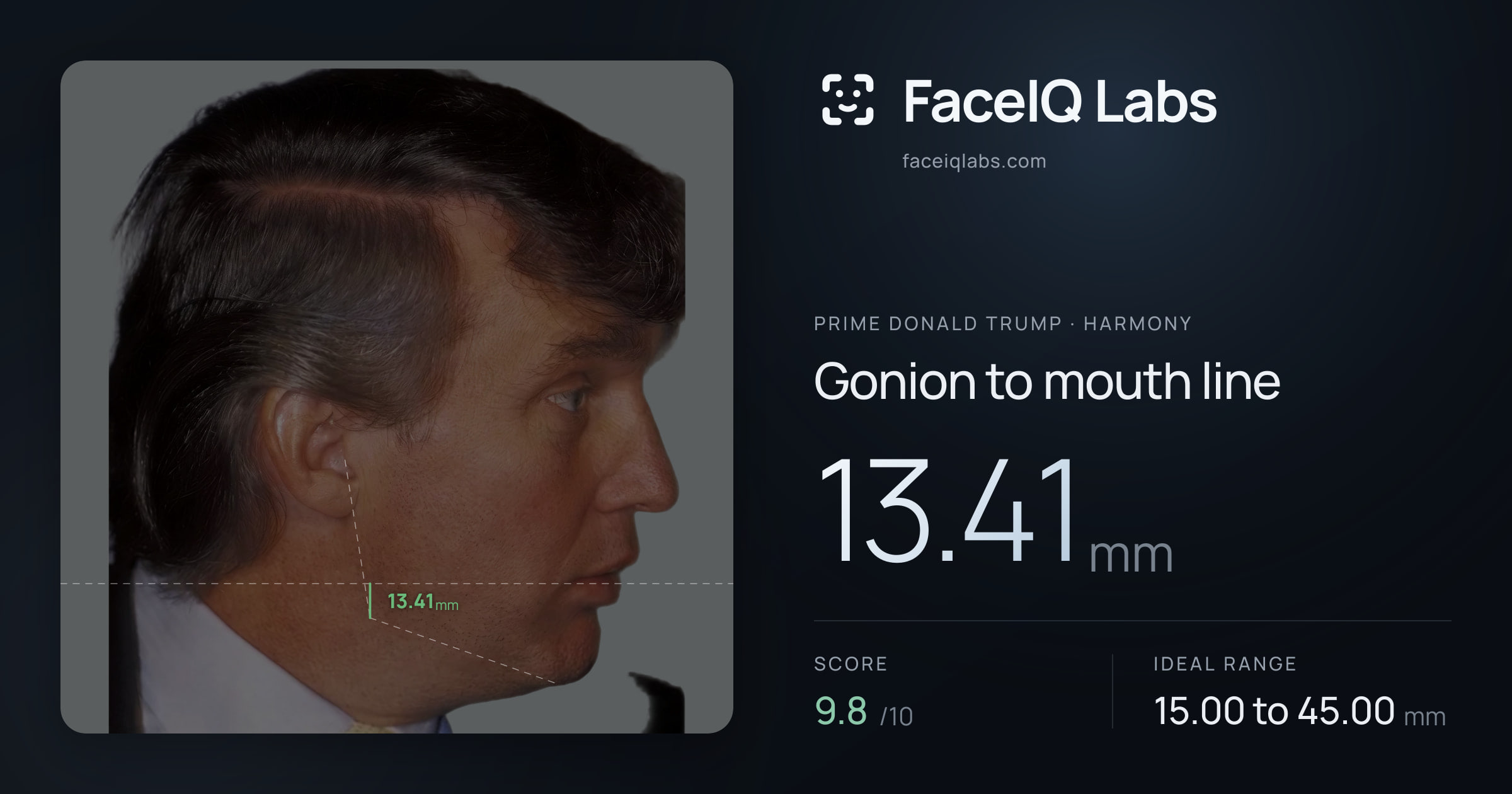 Prime Donald Trump Gonion to mouth line: 13.41mm, drawn on the photo