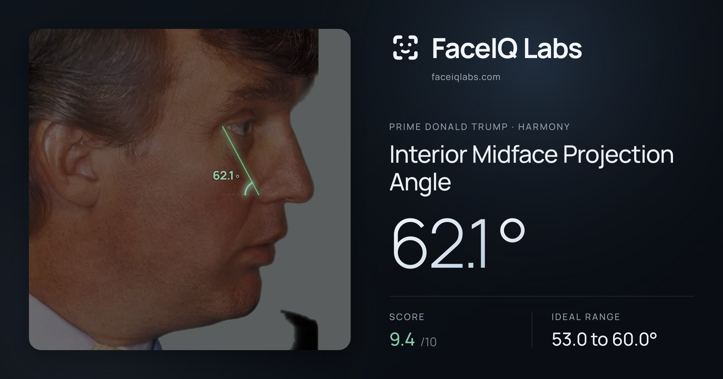 Prime Donald Trump Interior Midface Projection Angle: 62.1°, drawn on the photo