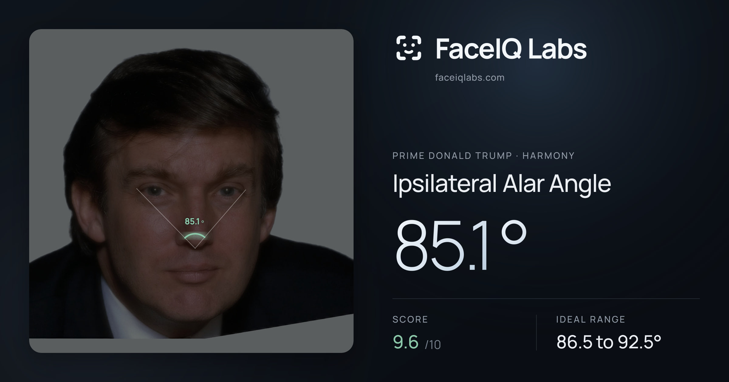 Prime Donald Trump Ipsilateral Alar Angle: 85.1°, drawn on the photo