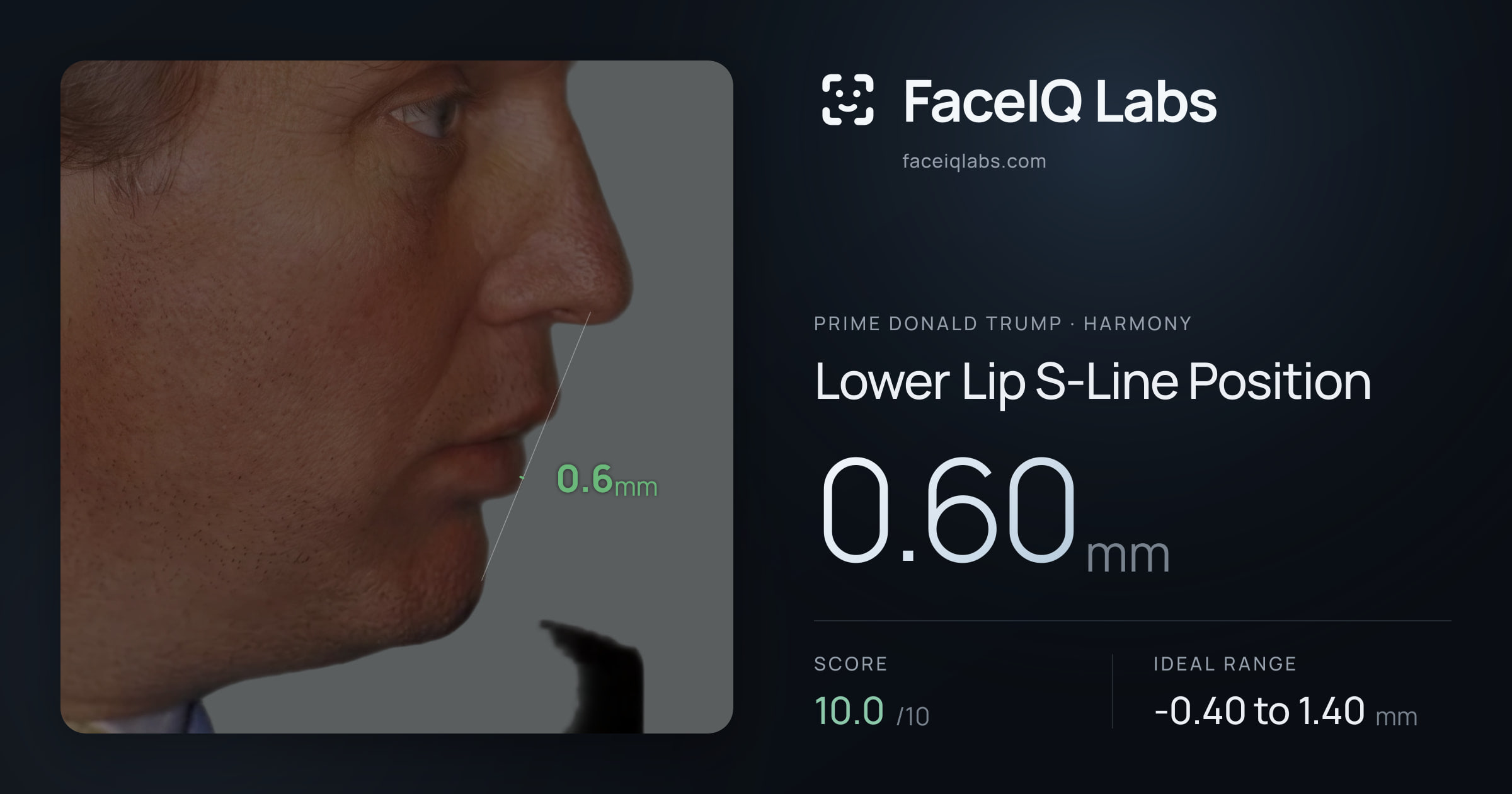 Prime Donald Trump Lower Lip S-Line Position: 0.60mm, drawn on the photo