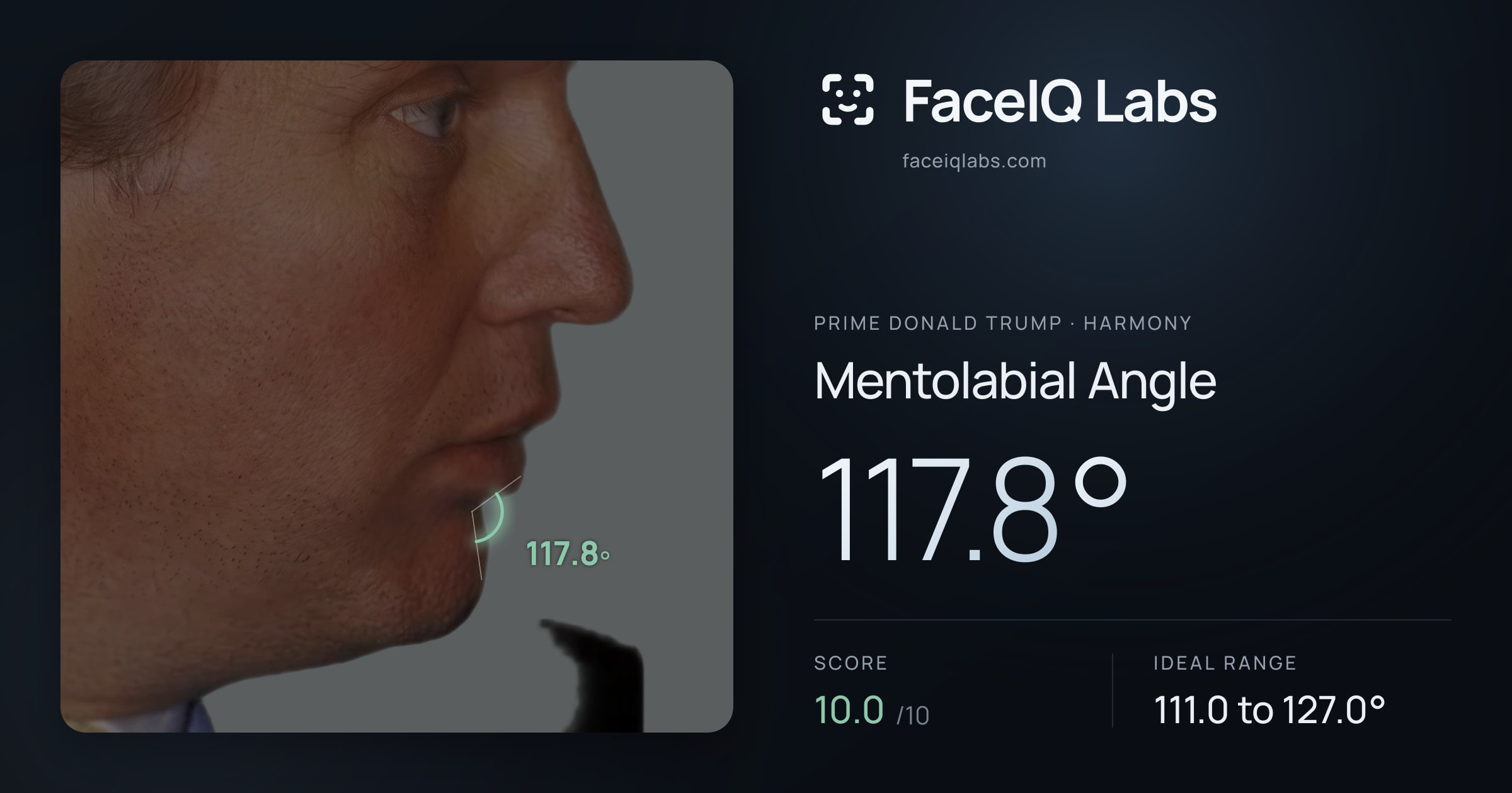 Prime Donald Trump Mentolabial Angle: 117.8°, drawn on the photo