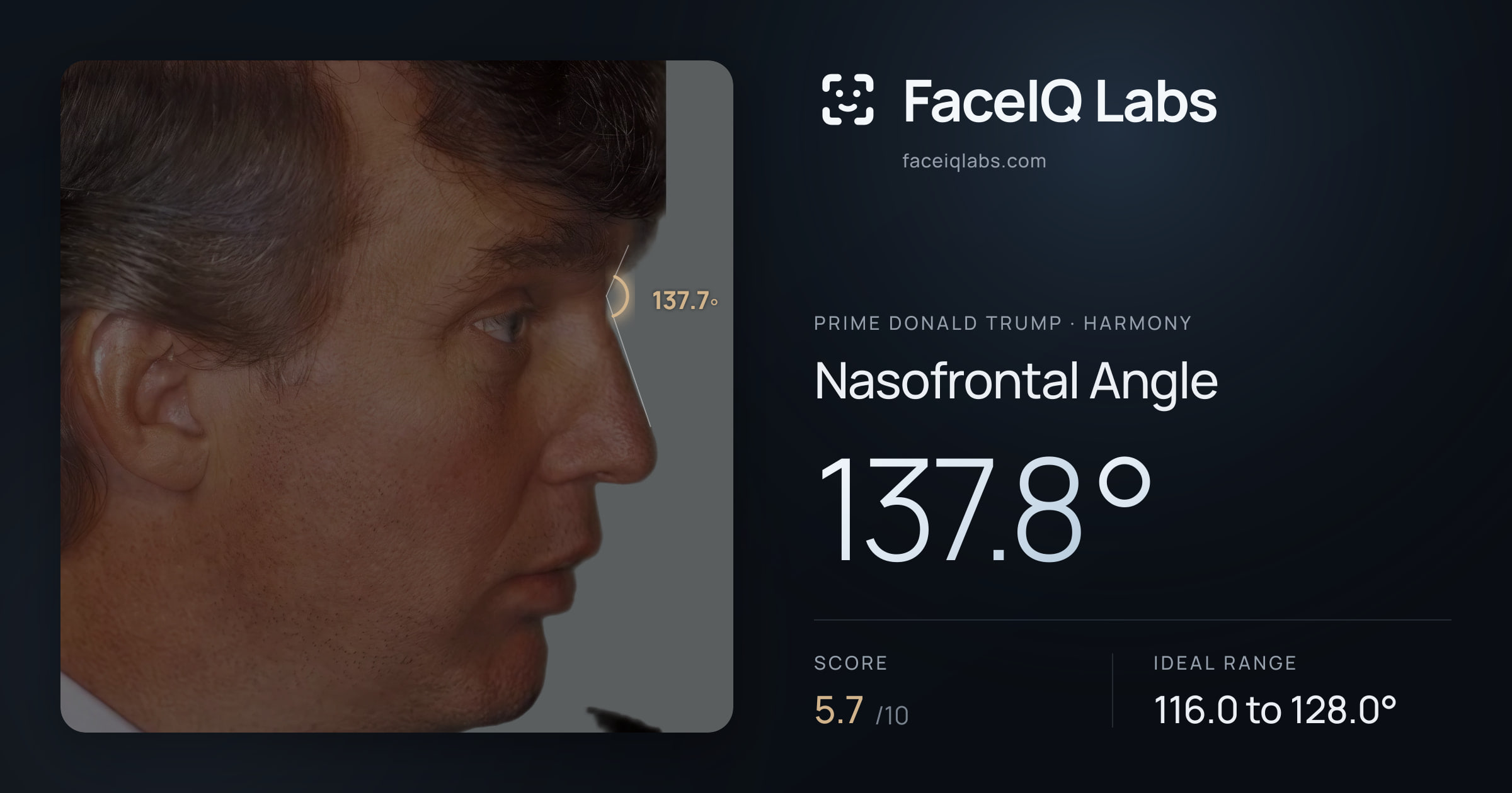 Prime Donald Trump Nasofrontal Angle: 137.8°, drawn on the photo