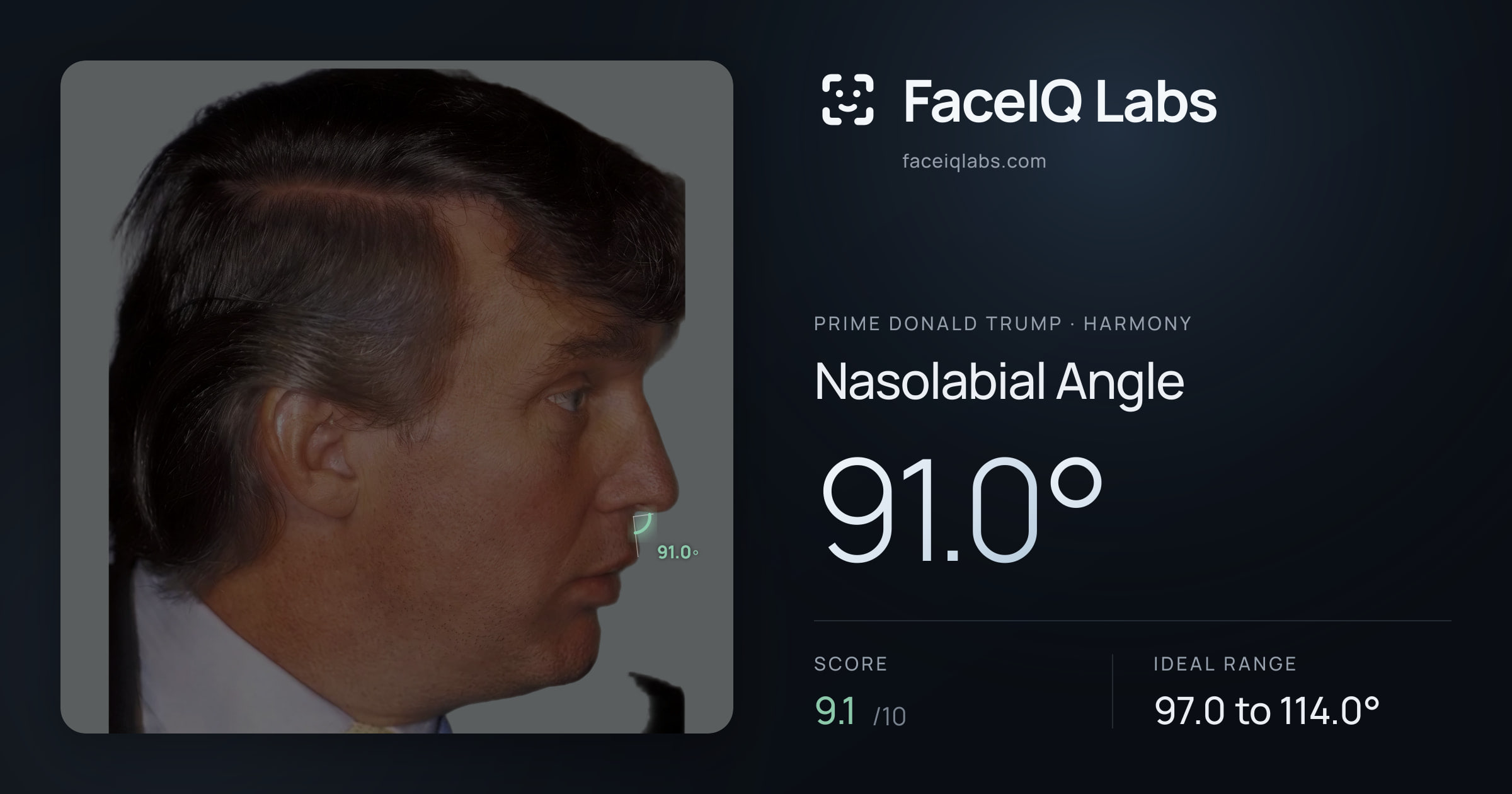 Prime Donald Trump Nasolabial Angle: 91.0°, drawn on the photo