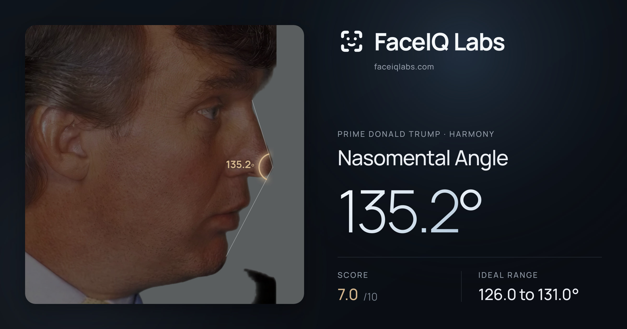 Prime Donald Trump Nasomental Angle: 135.2°, drawn on the photo