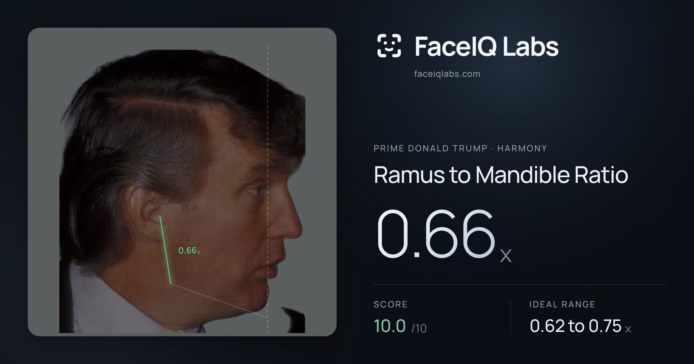 Prime Donald Trump Ramus to Mandible Ratio: 0.66x, drawn on the photo