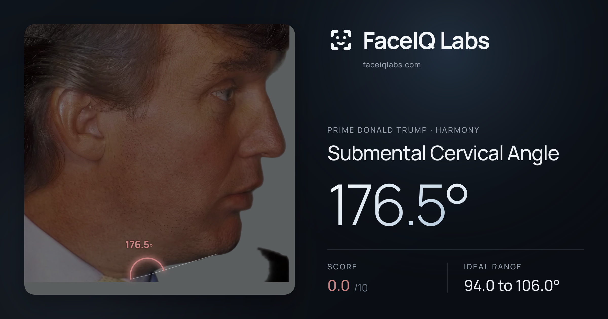 Prime Donald Trump Submental Cervical Angle: 176.5°, drawn on the photo