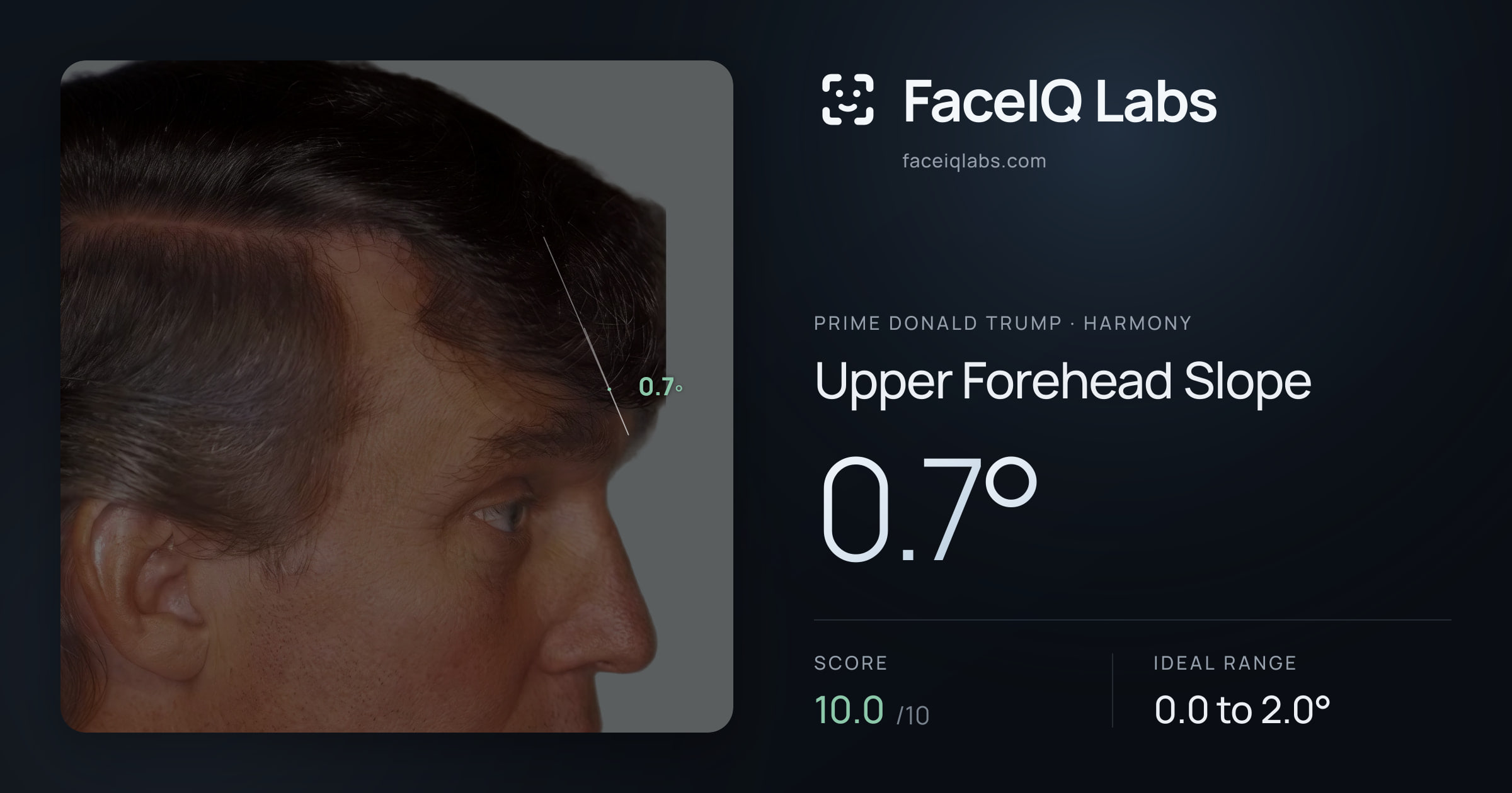 Prime Donald Trump Upper Forehead Slope: 0.7°, drawn on the photo