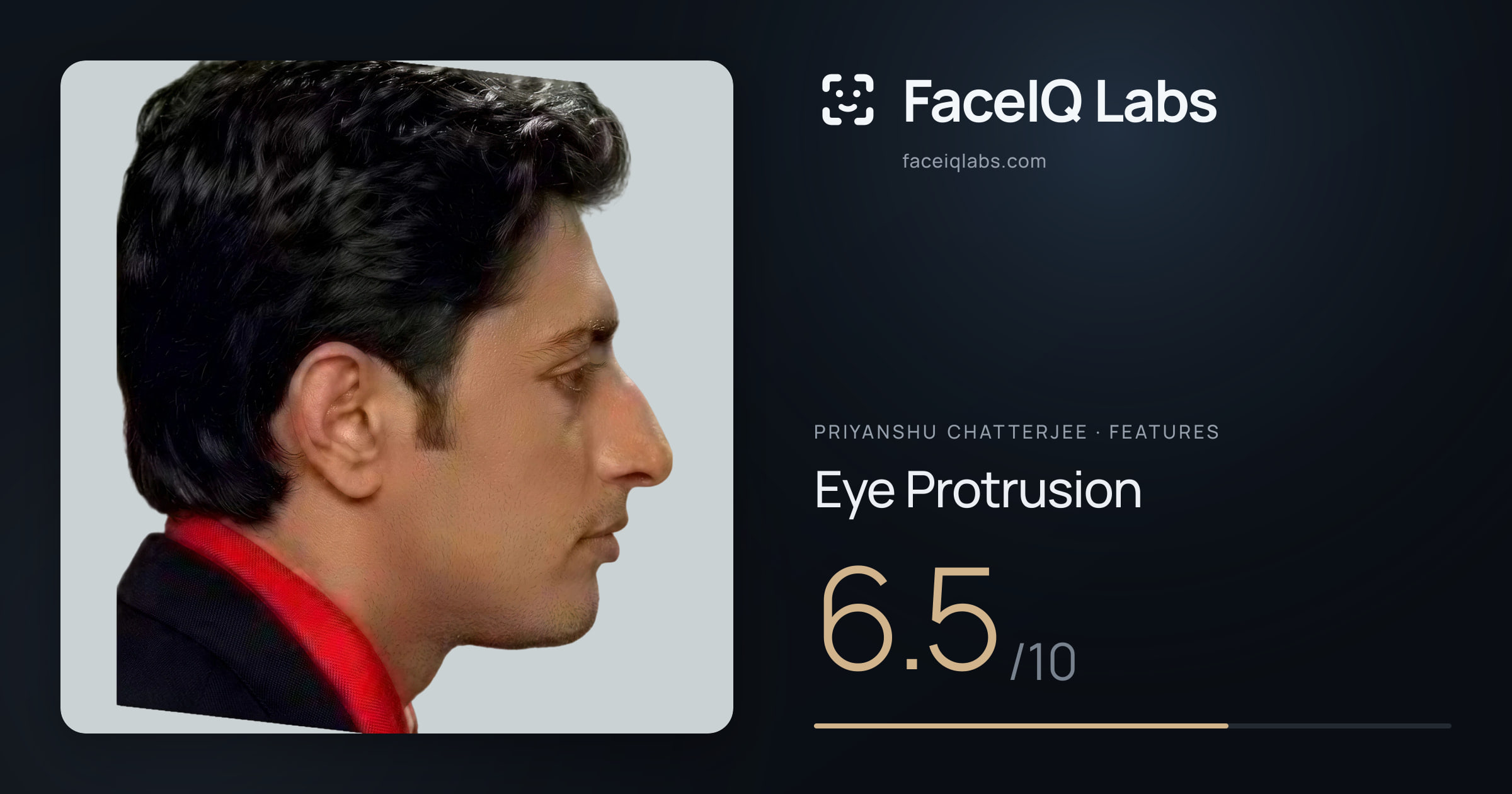Priyanshu Chatterjee Eye Protrusion: 6.5/10, drawn on the photo