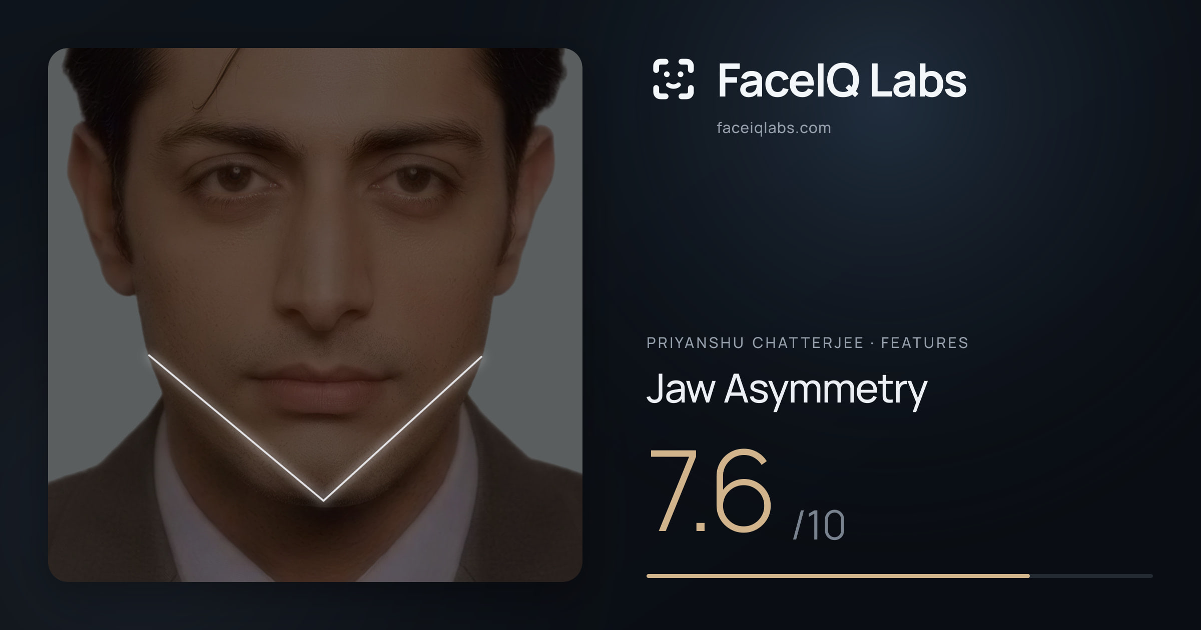 Priyanshu Chatterjee Jaw Asymmetry: 7.6/10, drawn on the photo