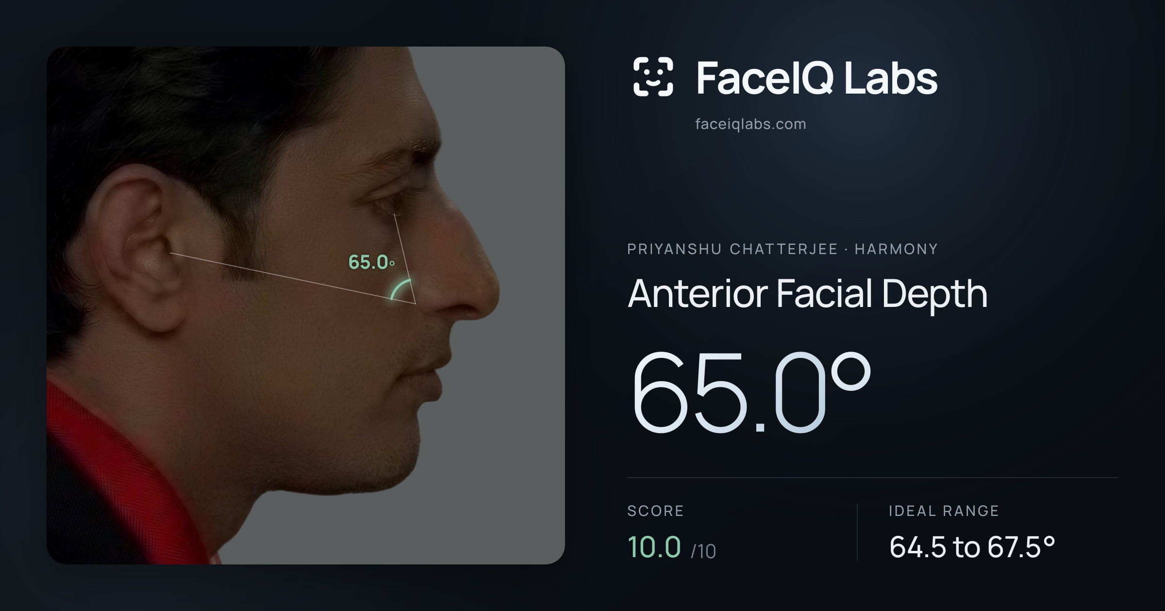 Priyanshu Chatterjee Anterior Facial Depth: 65.0°, drawn on the photo
