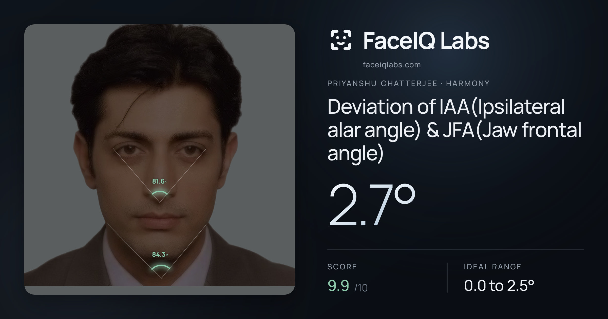 Priyanshu Chatterjee Deviation of IAA(Ipsilateral alar angle) & JFA(Jaw frontal angle): 2.7°, drawn on the photo