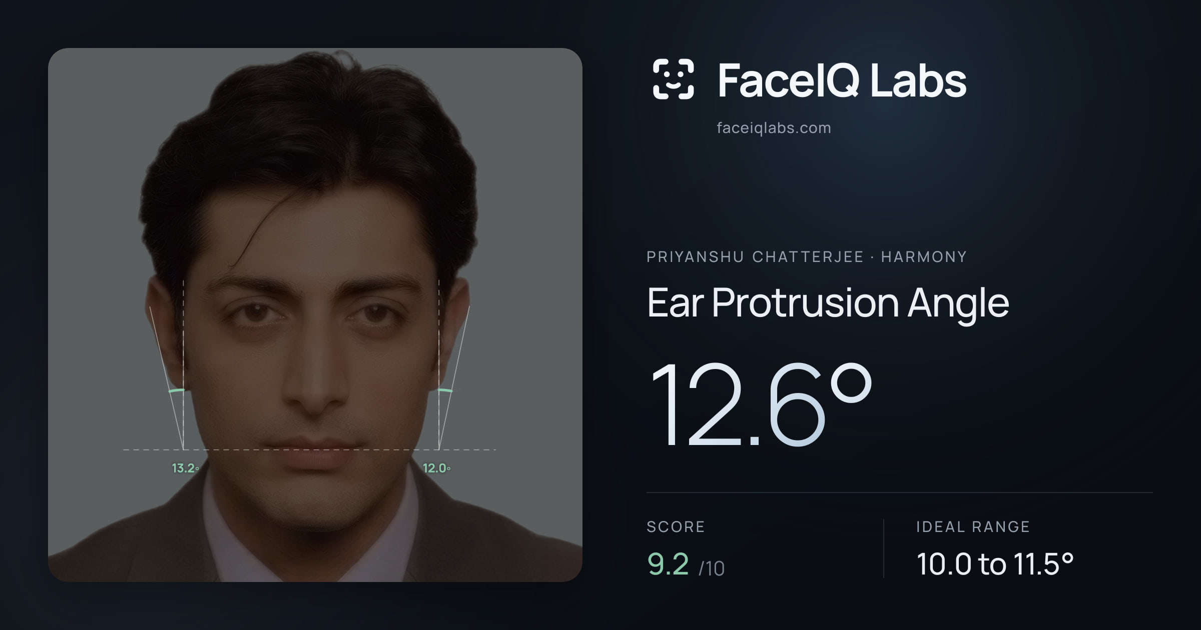 Priyanshu Chatterjee Ear Protrusion Angle: 12.6°, drawn on the photo