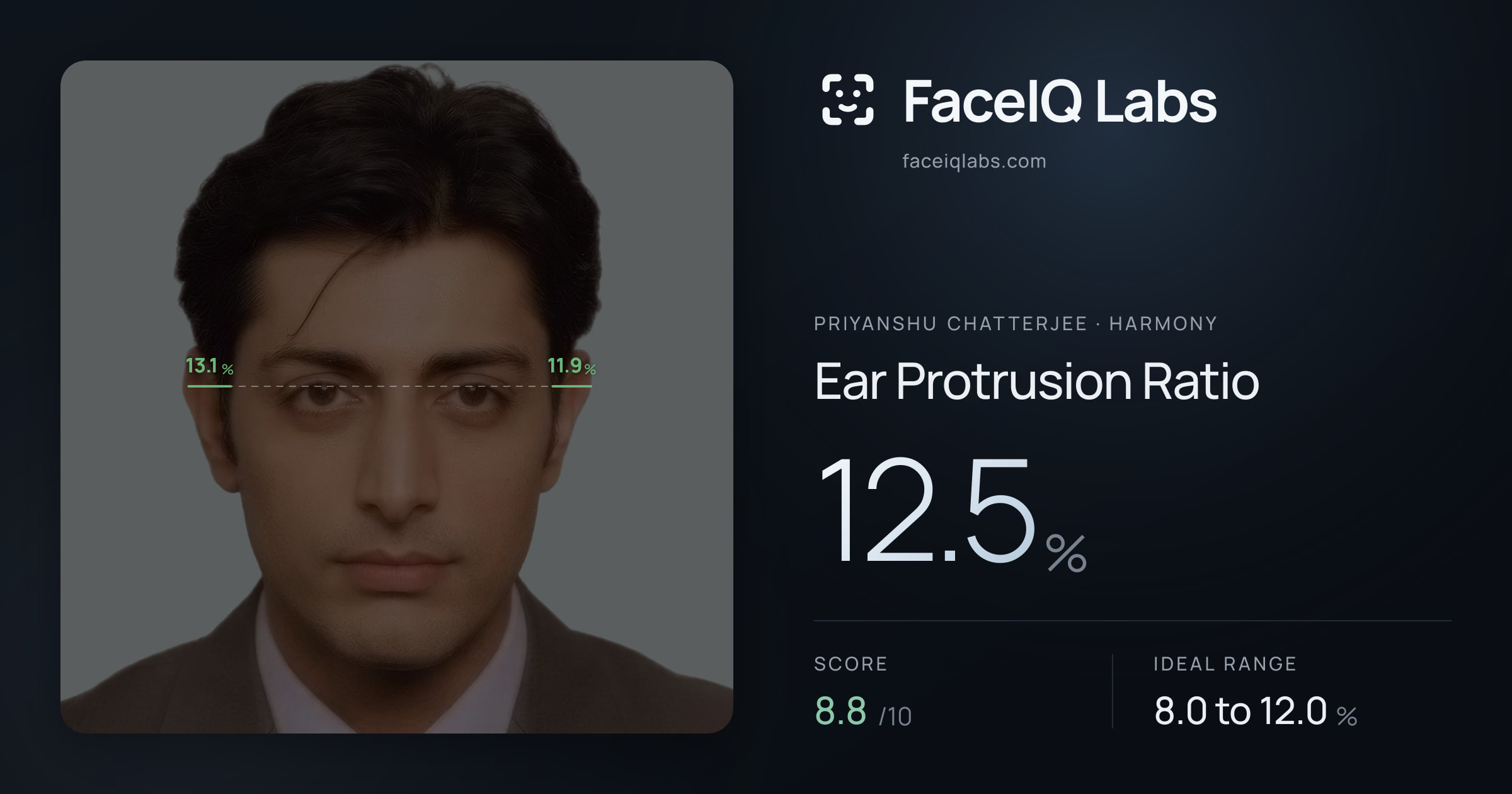 Priyanshu Chatterjee Ear Protrusion Ratio: 12.5%, drawn on the photo