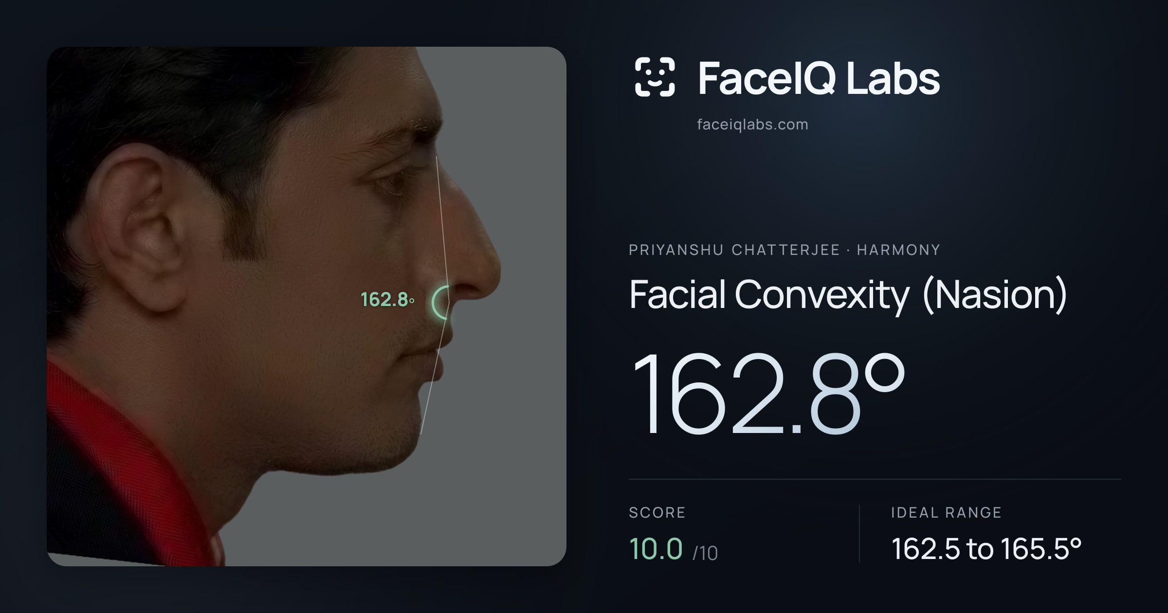 Priyanshu Chatterjee Facial Convexity (Nasion): 162.8°, drawn on the photo