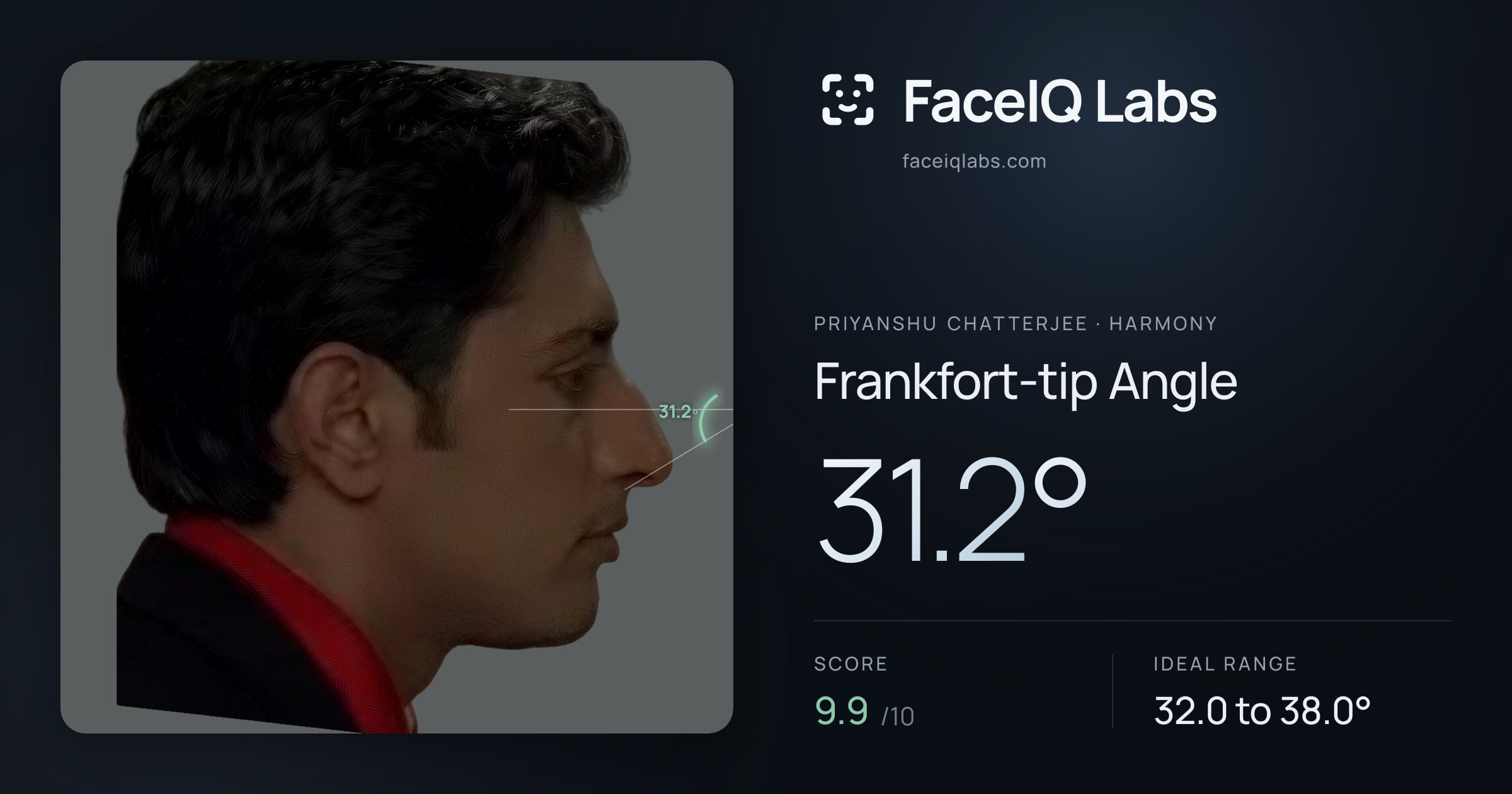 Priyanshu Chatterjee Frankfort-tip Angle: 31.2°, drawn on the photo