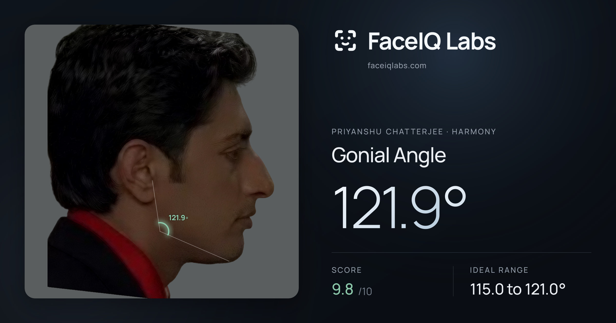Priyanshu Chatterjee Gonial Angle: 121.9°, drawn on the photo