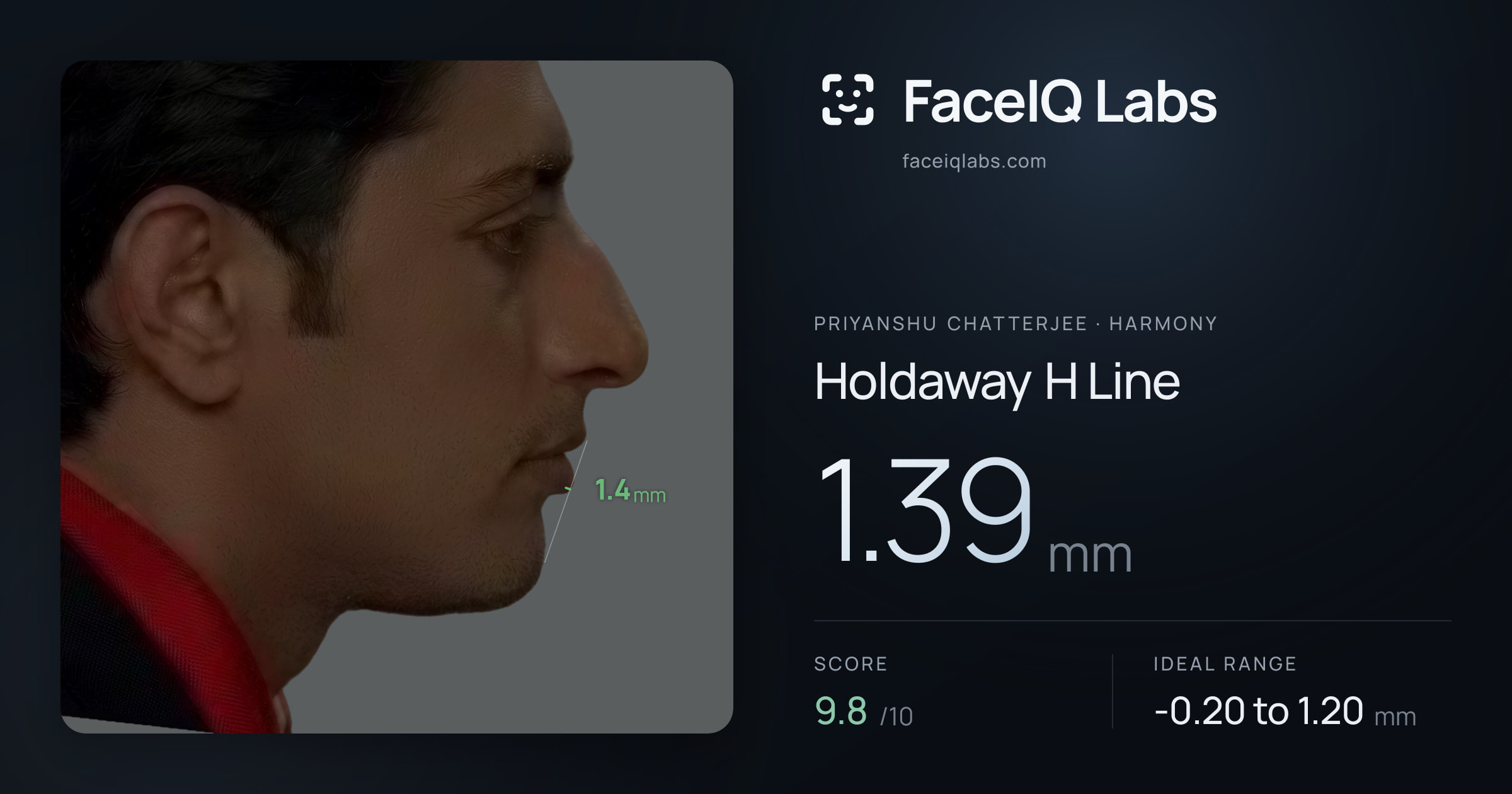 Priyanshu Chatterjee Holdaway H Line: 1.39mm, drawn on the photo