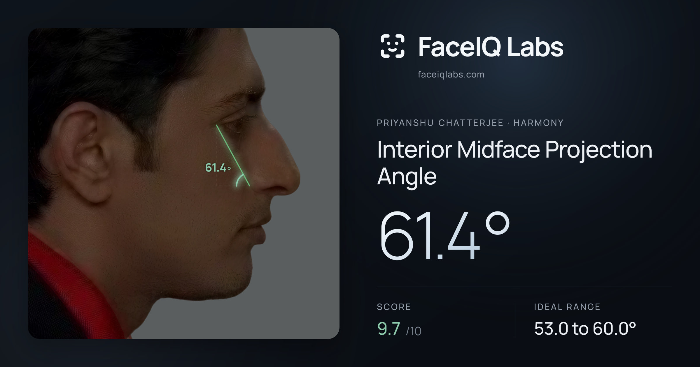 Priyanshu Chatterjee Interior Midface Projection Angle: 61.4°, drawn on the photo