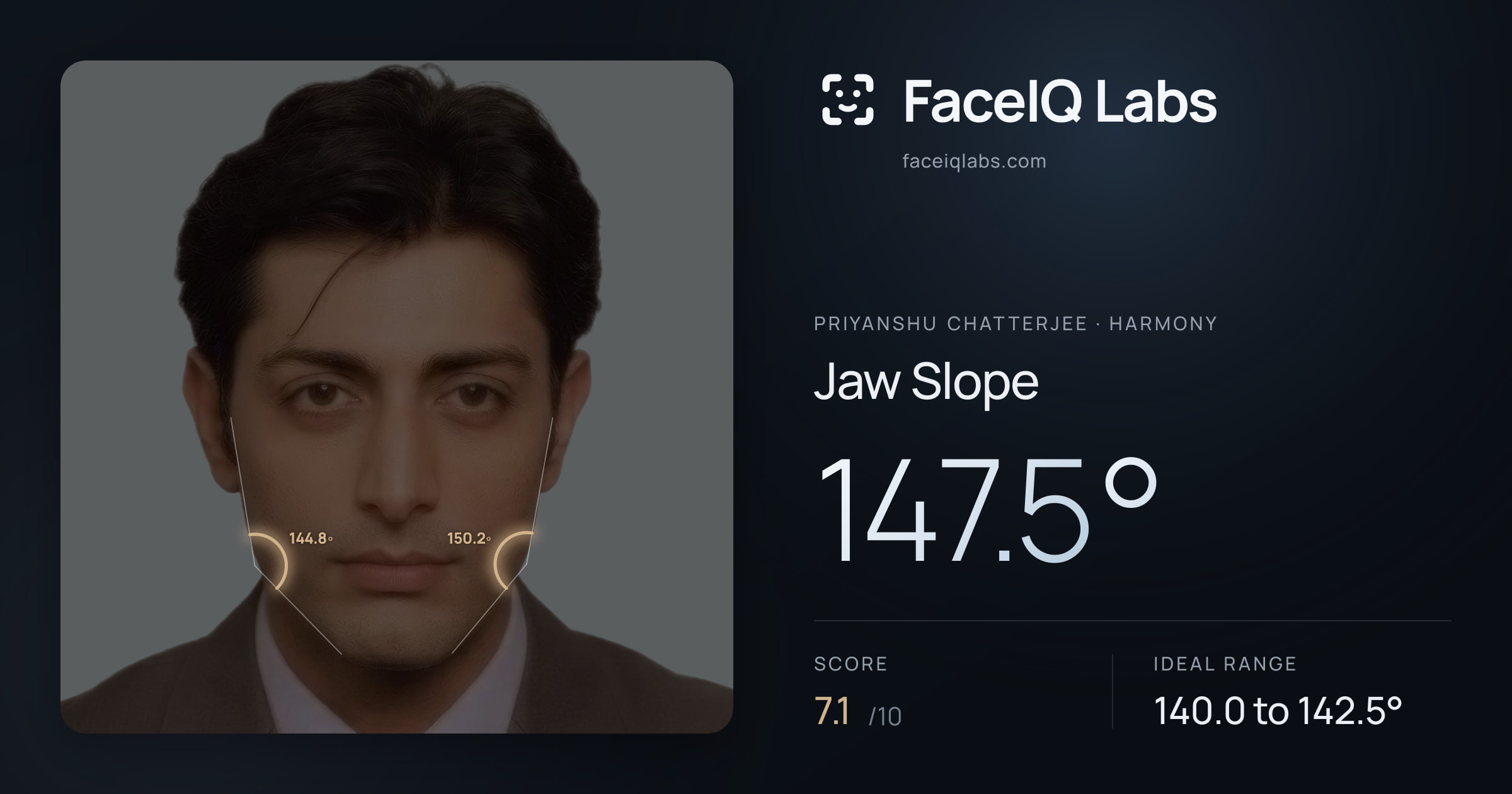 Priyanshu Chatterjee Jaw Slope: 147.5°, drawn on the photo