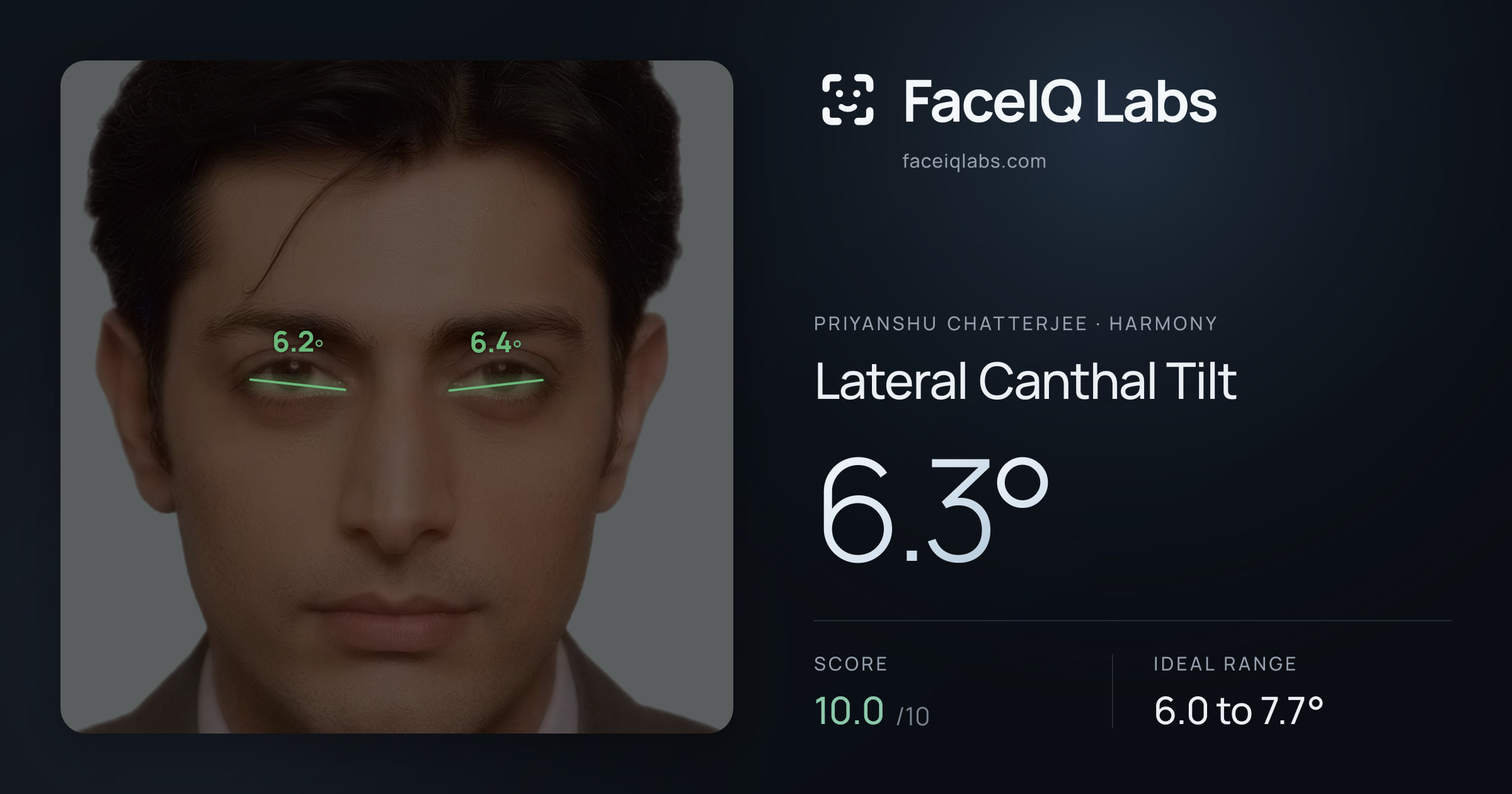 Priyanshu Chatterjee Lateral Canthal Tilt: 6.3°, drawn on the photo