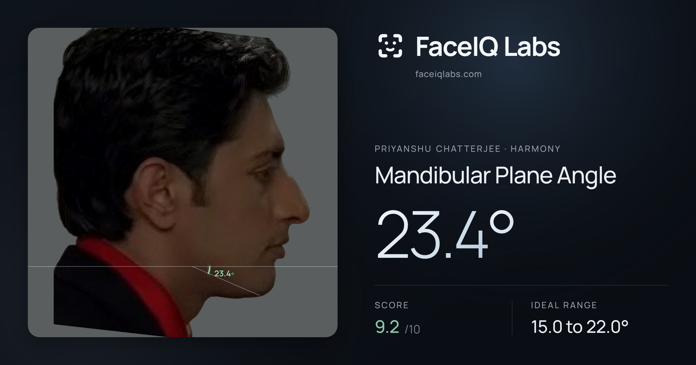 Priyanshu Chatterjee Mandibular Plane Angle: 23.4°, drawn on the photo