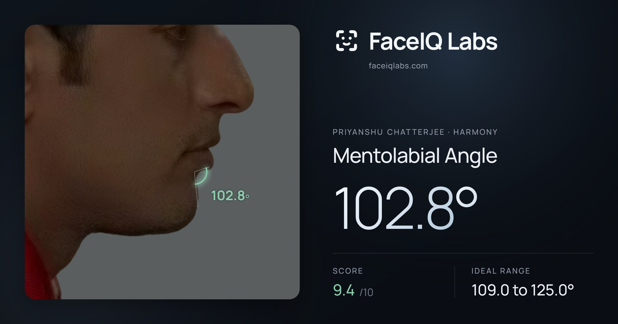 Priyanshu Chatterjee Mentolabial Angle: 102.8°, drawn on the photo