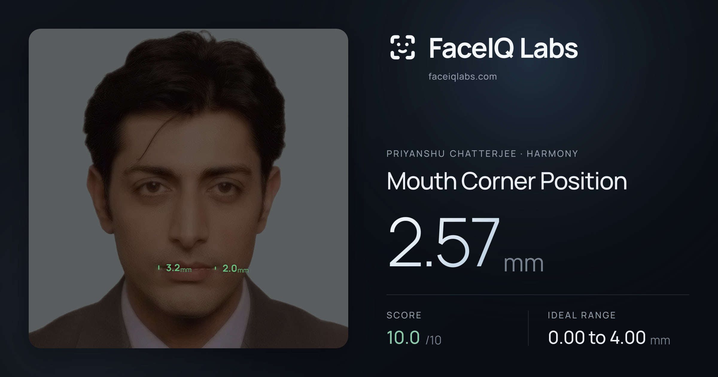 Priyanshu Chatterjee Mouth Corner Position: 2.57mm, drawn on the photo
