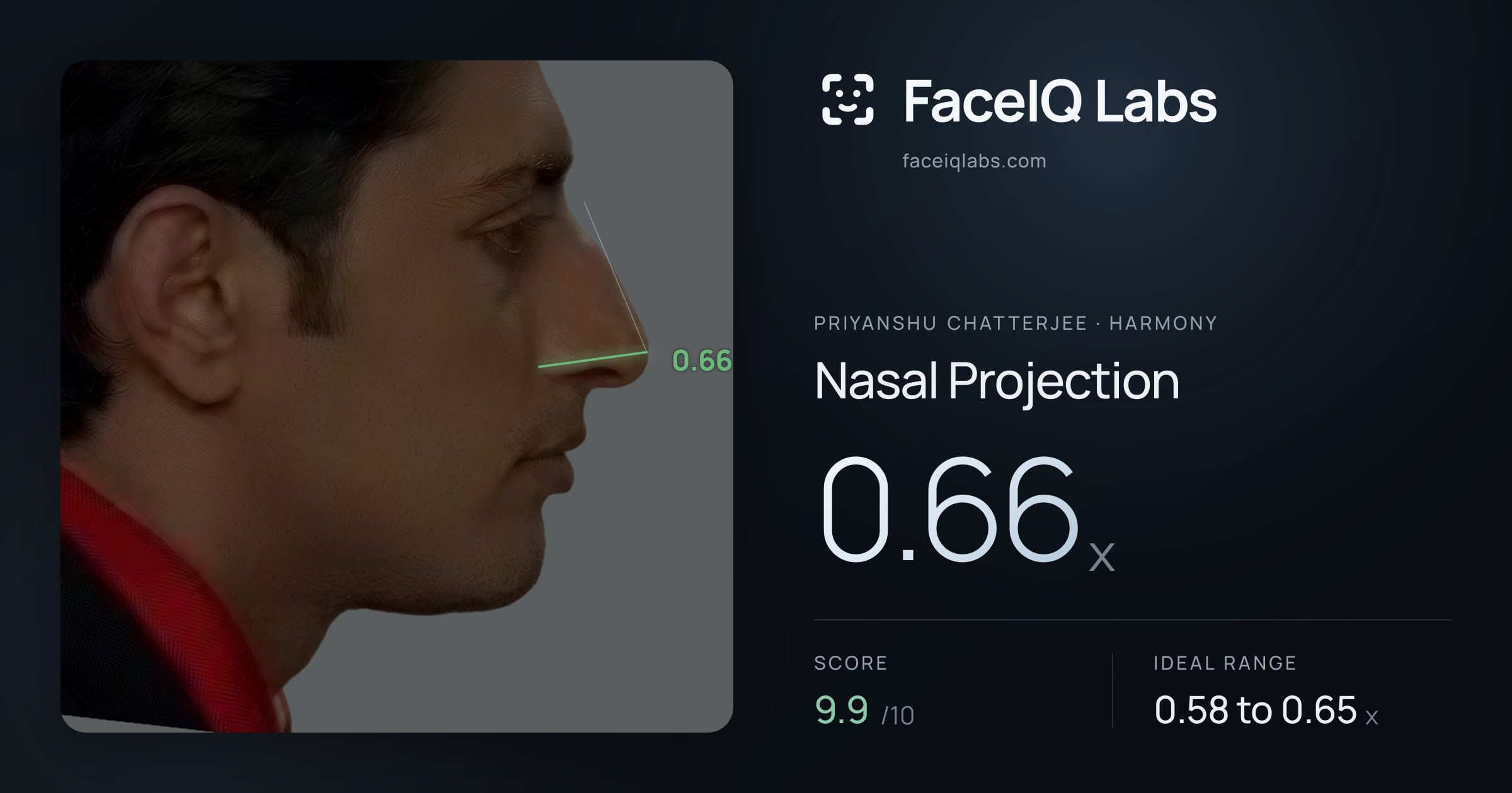 Priyanshu Chatterjee Nasal Projection: 0.66x, drawn on the photo