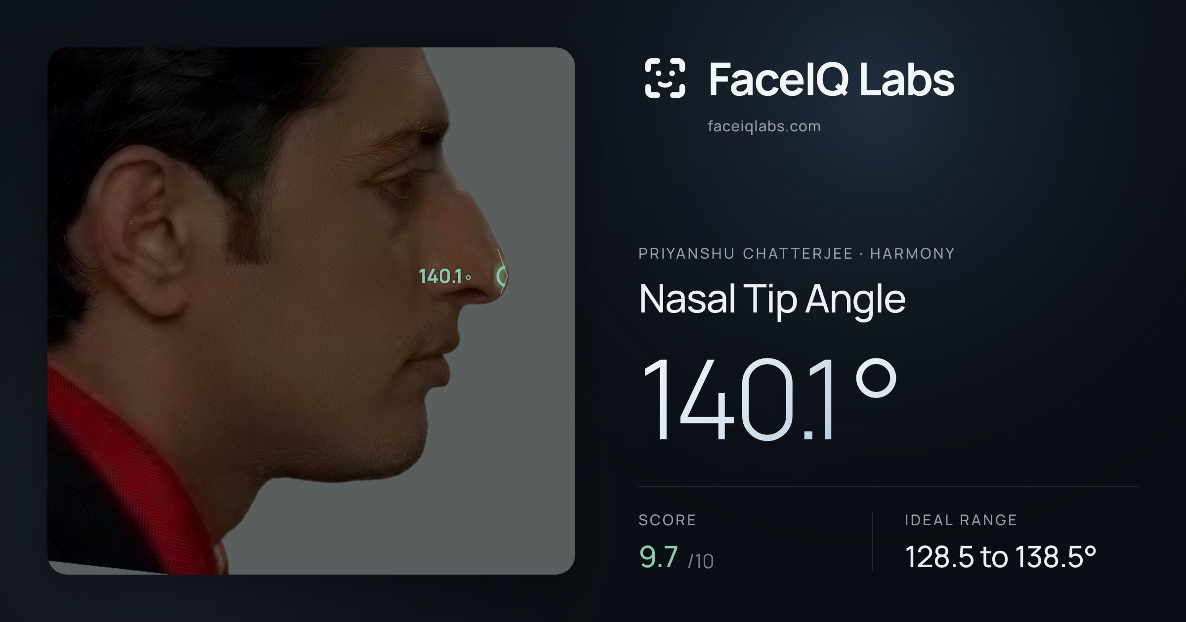 Priyanshu Chatterjee Nasal Tip Angle: 140.1°, drawn on the photo