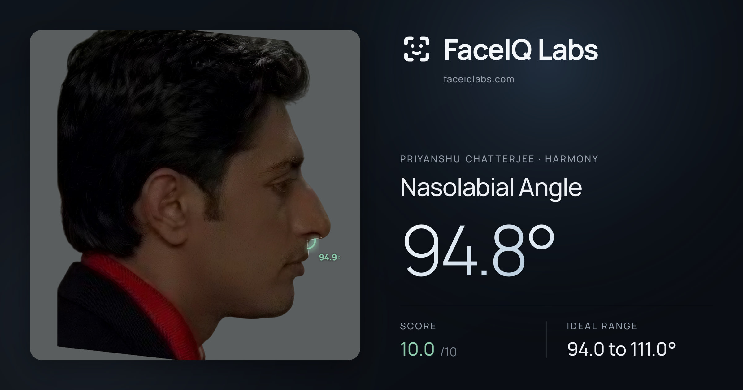 Priyanshu Chatterjee Nasolabial Angle: 94.8°, drawn on the photo