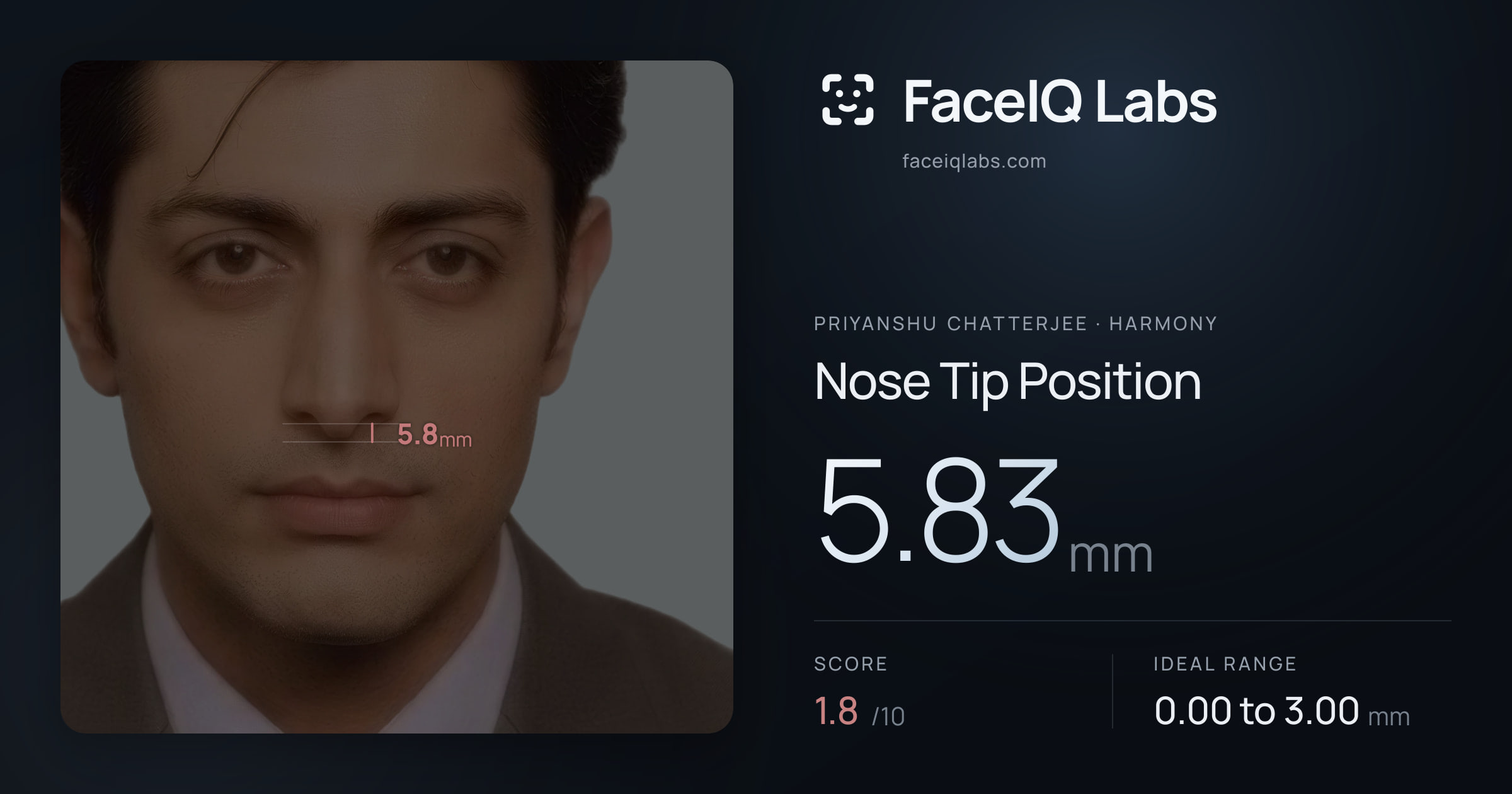 Priyanshu Chatterjee Nose Tip Position: 5.83mm, drawn on the photo