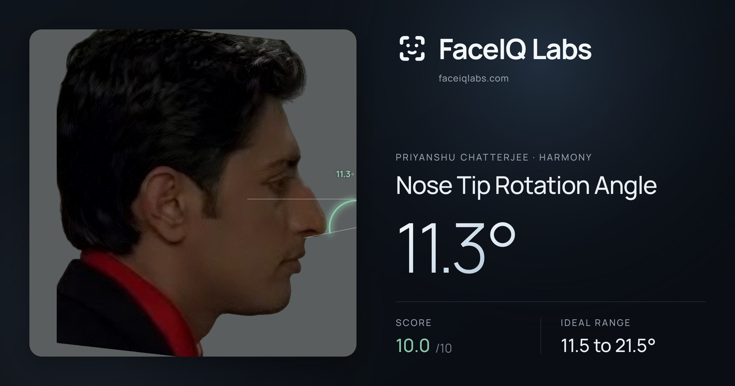 Priyanshu Chatterjee Nose Tip Rotation Angle: 11.3°, drawn on the photo