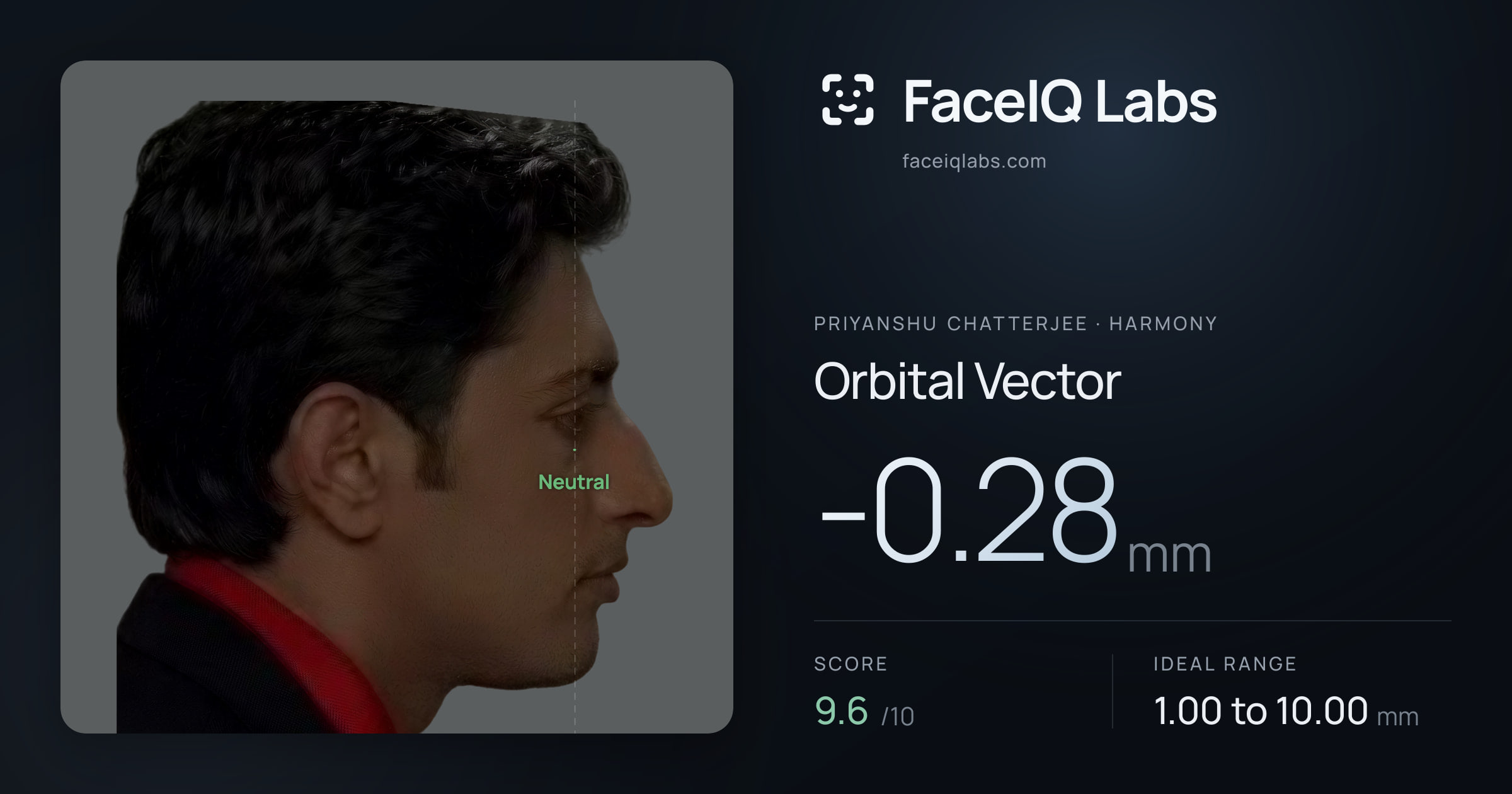 Priyanshu Chatterjee Orbital Vector: -0.28mm, drawn on the photo