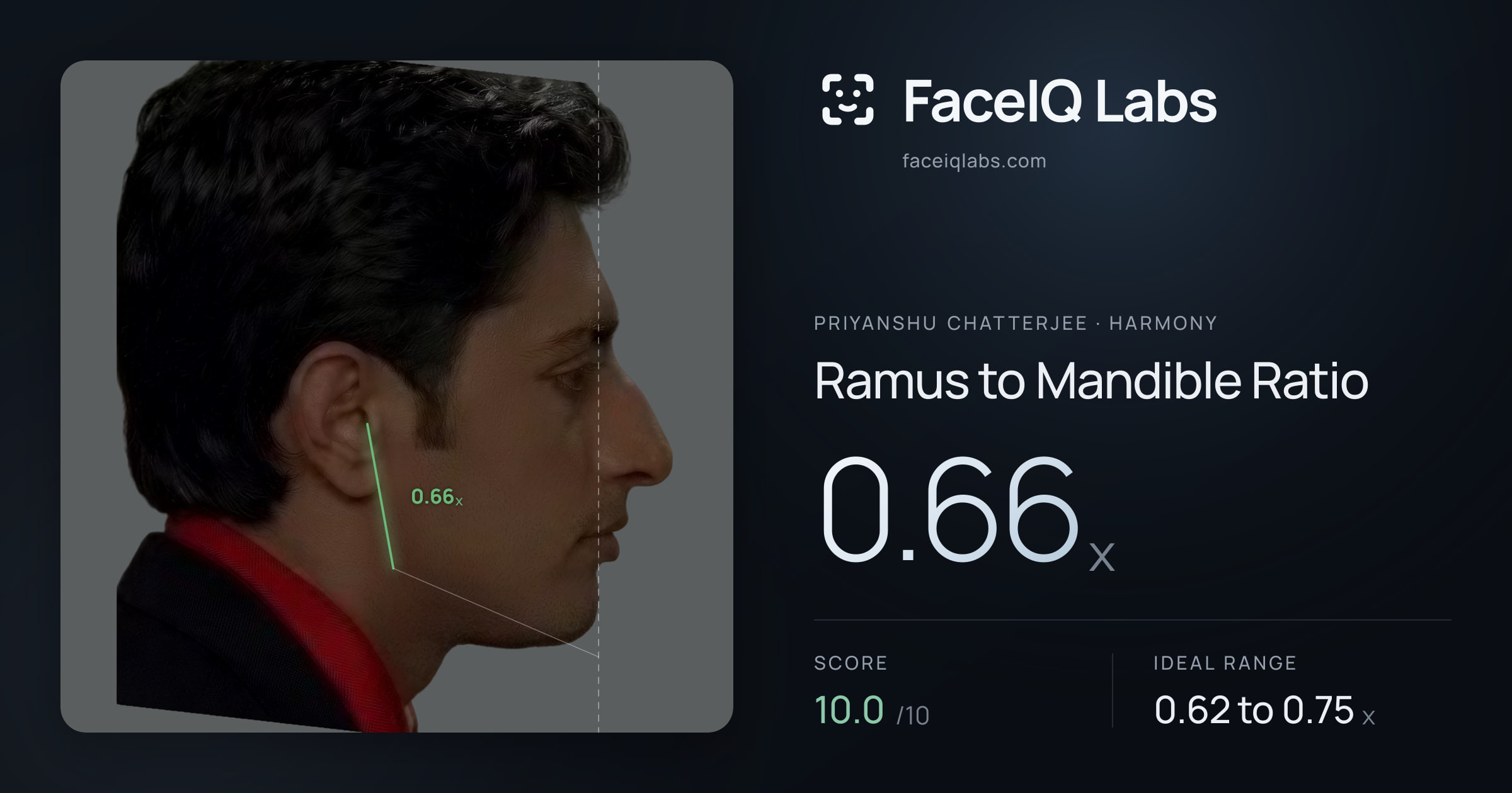 Priyanshu Chatterjee Ramus to Mandible Ratio: 0.66x, drawn on the photo