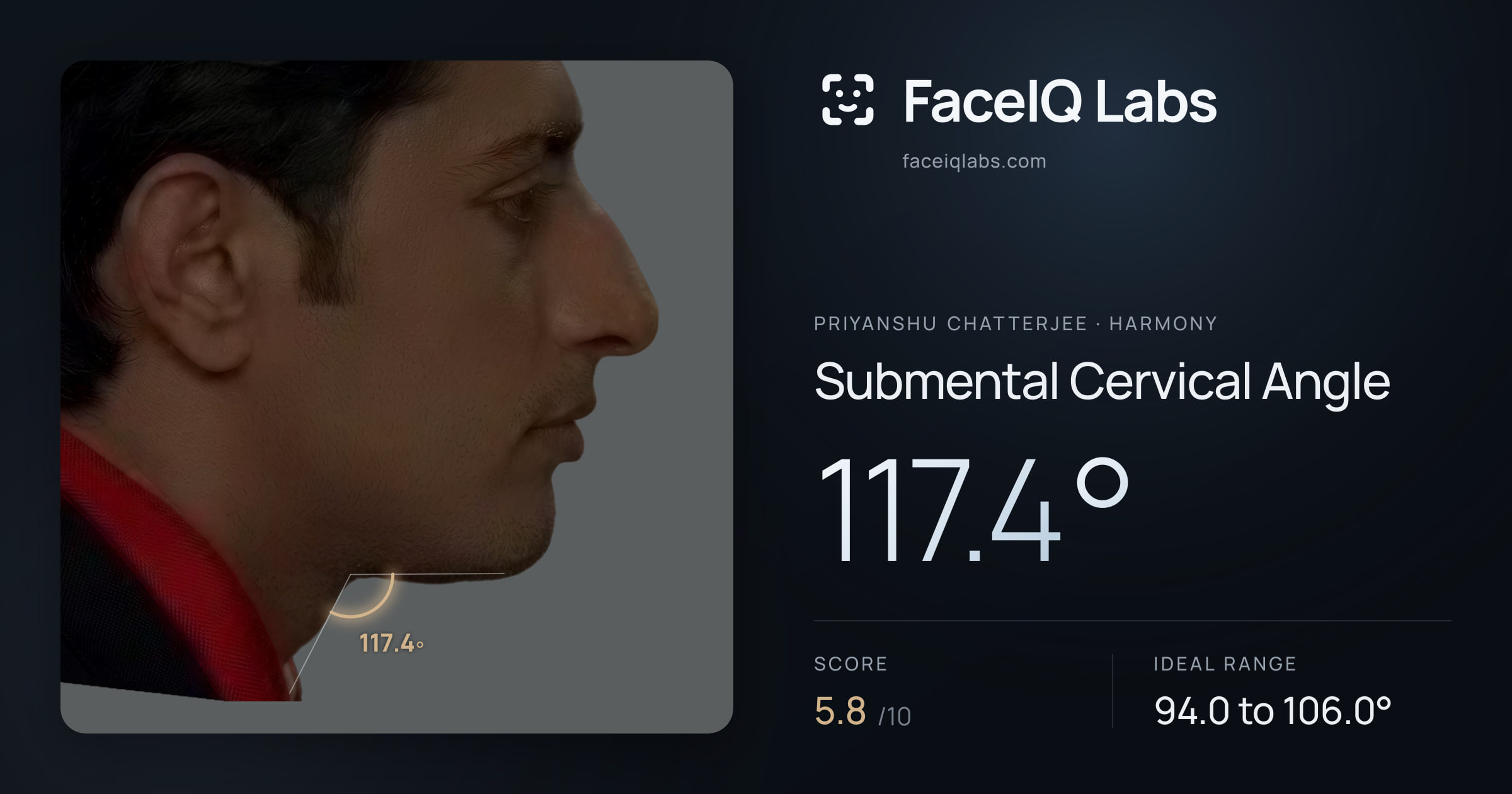 Priyanshu Chatterjee Submental Cervical Angle: 117.4°, drawn on the photo