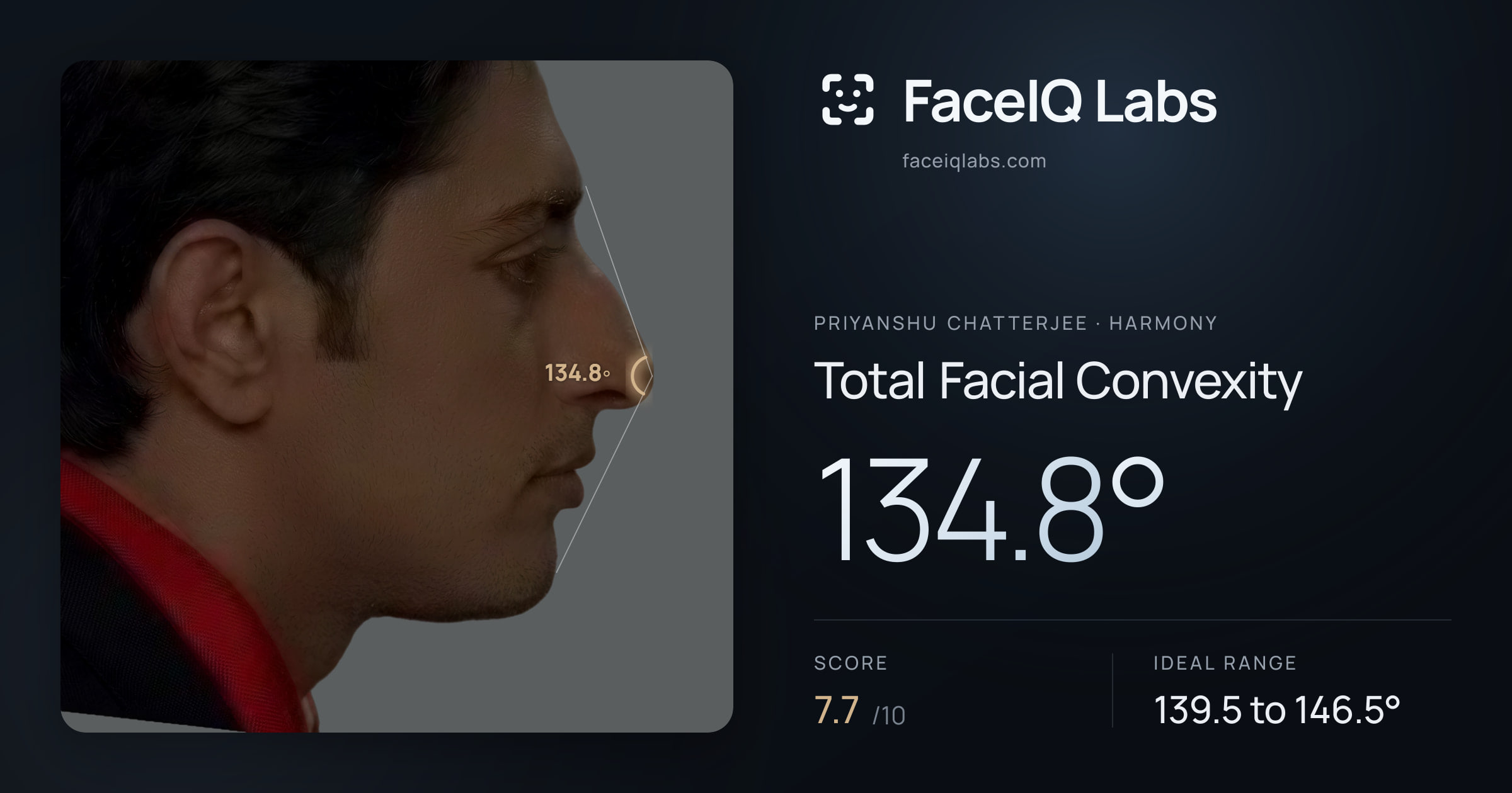 Priyanshu Chatterjee Total Facial Convexity: 134.8°, drawn on the photo
