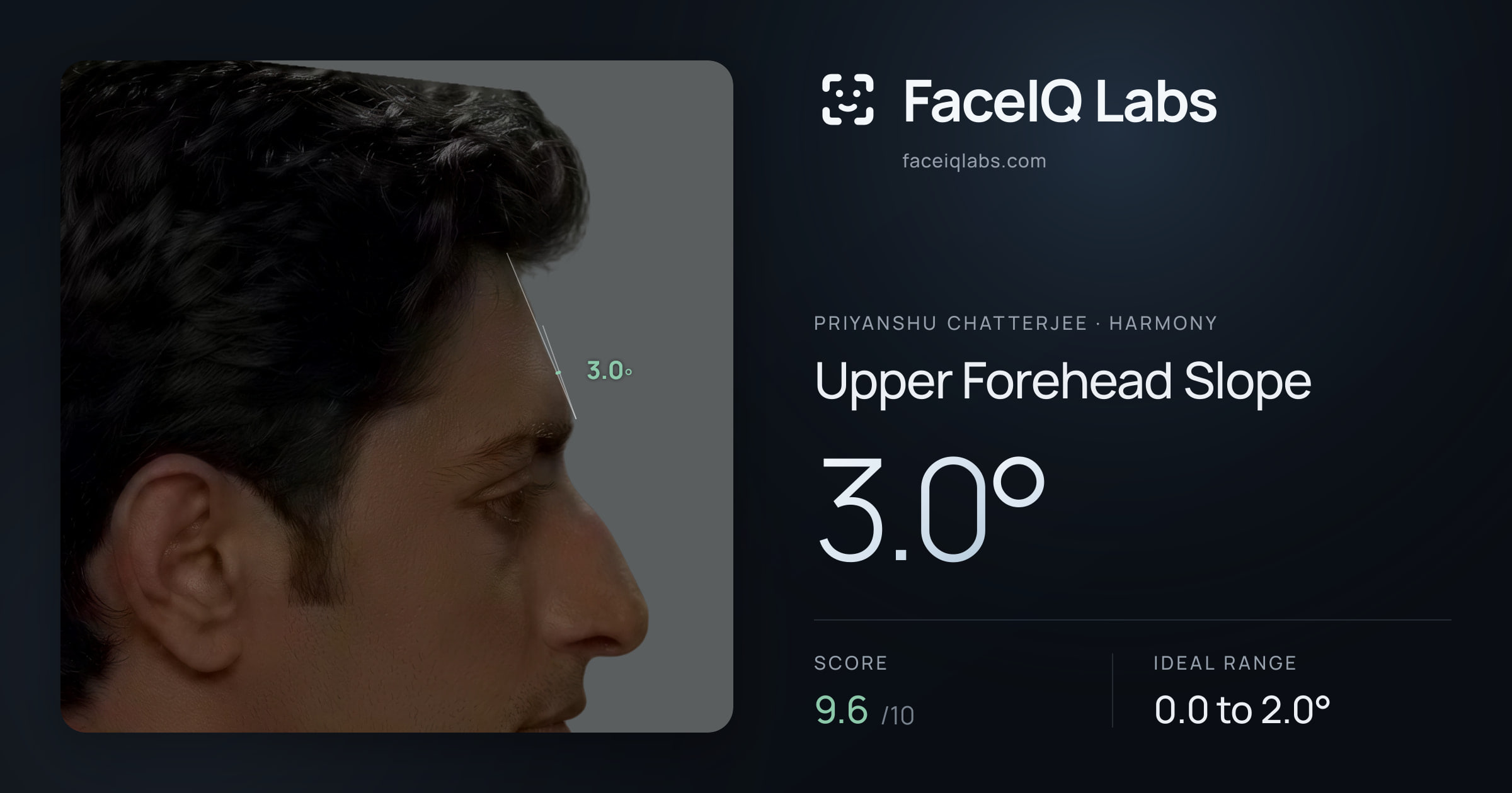 Priyanshu Chatterjee Upper Forehead Slope: 3.0°, drawn on the photo