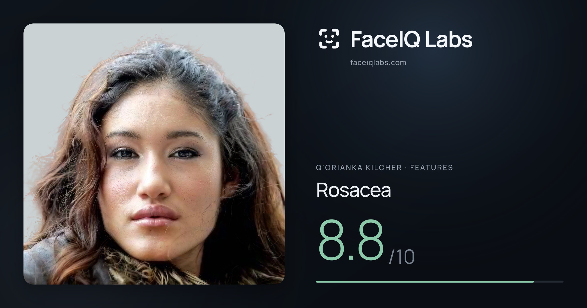 Q'orianka Kilcher Rosacea: 8.8/10, drawn on the photo