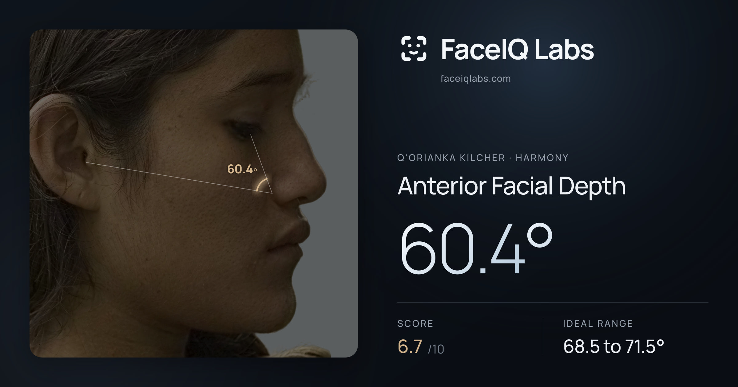 Q'orianka Kilcher Anterior Facial Depth: 60.4°, drawn on the photo