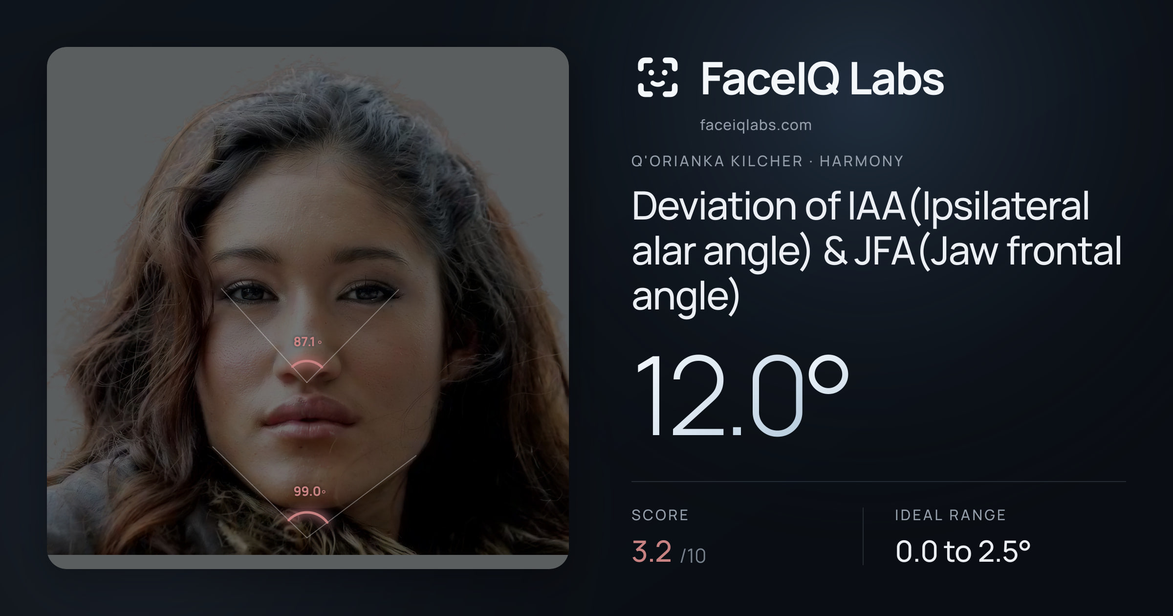 Q'orianka Kilcher Deviation of IAA(Ipsilateral alar angle) & JFA(Jaw frontal angle): 12.0°, drawn on the photo