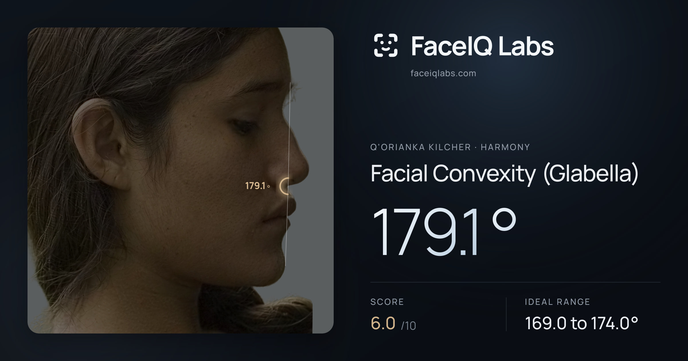 Q'orianka Kilcher Facial Convexity (Glabella): 179.1°, drawn on the photo