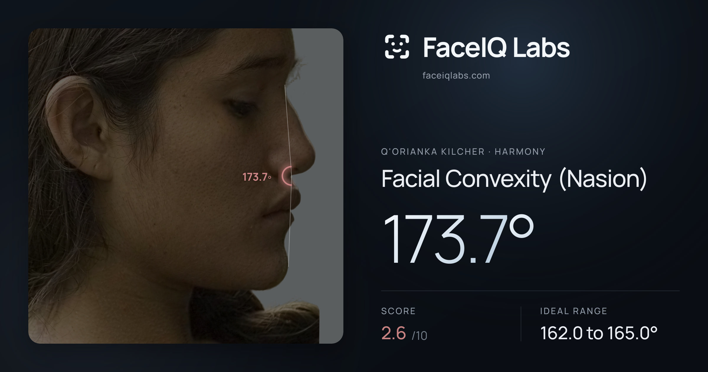 Q'orianka Kilcher Facial Convexity (Nasion): 173.7°, drawn on the photo