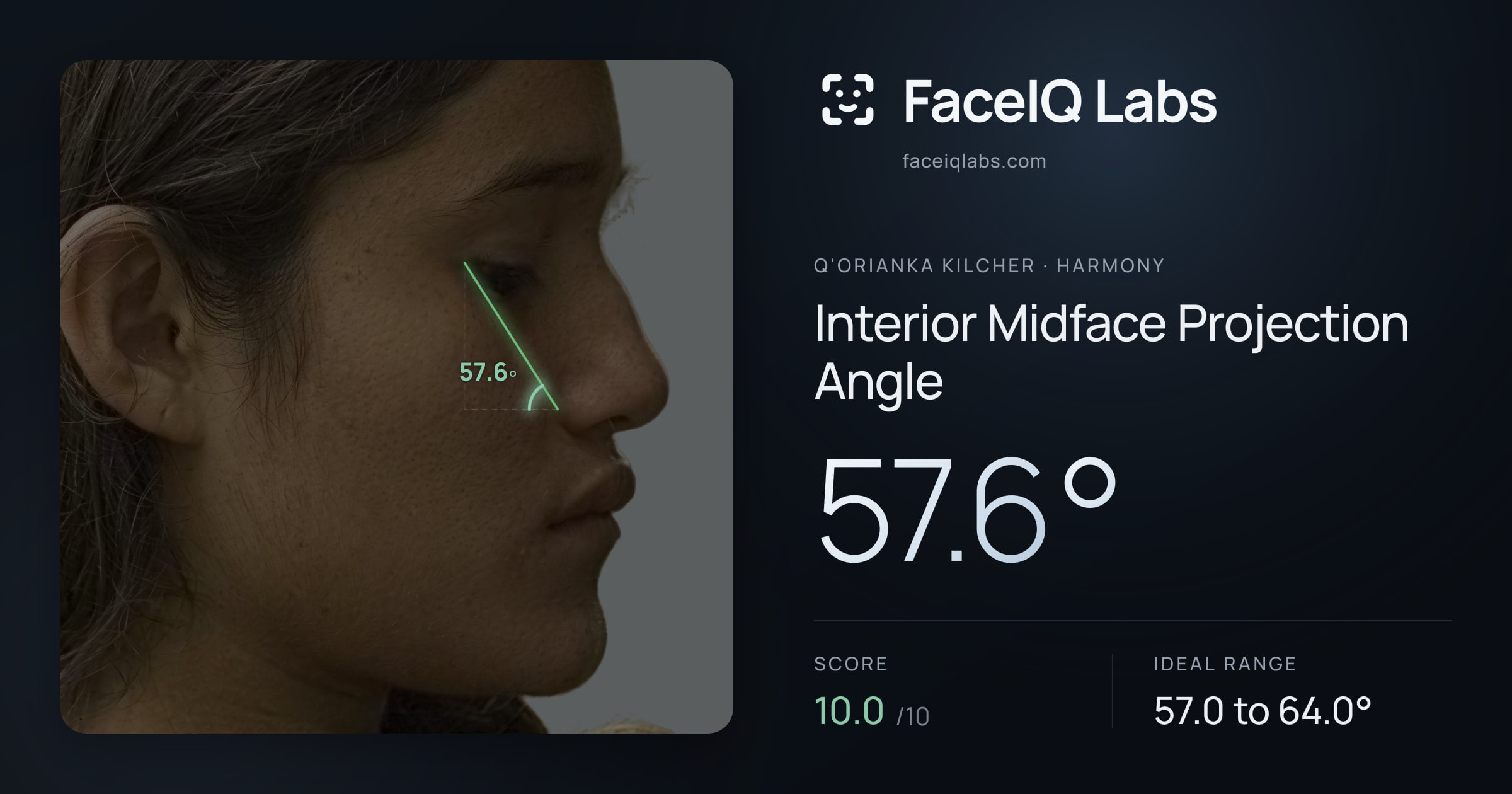 Q'orianka Kilcher Interior Midface Projection Angle: 57.6°, drawn on the photo