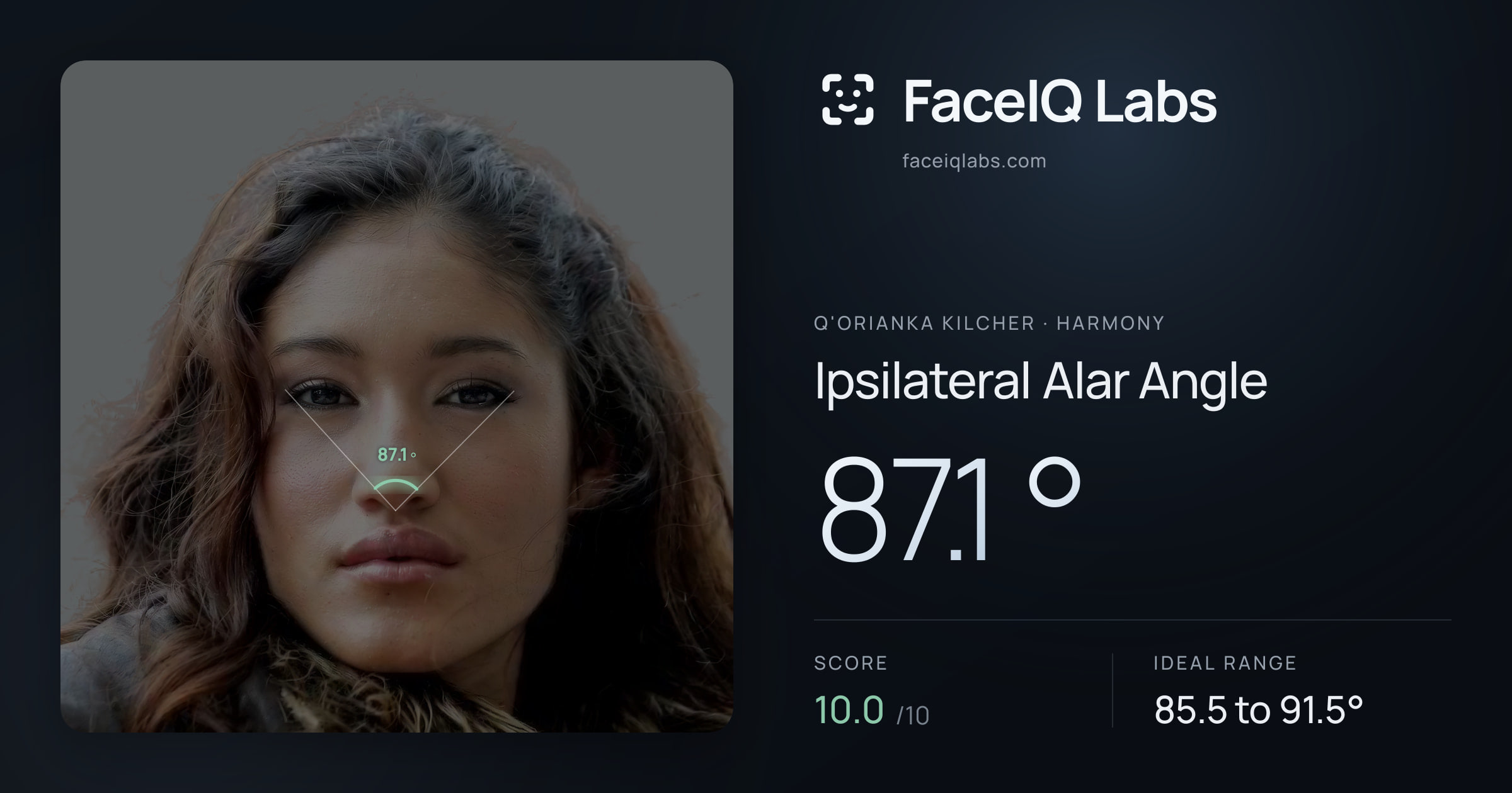 Q'orianka Kilcher Ipsilateral Alar Angle: 87.1°, drawn on the photo