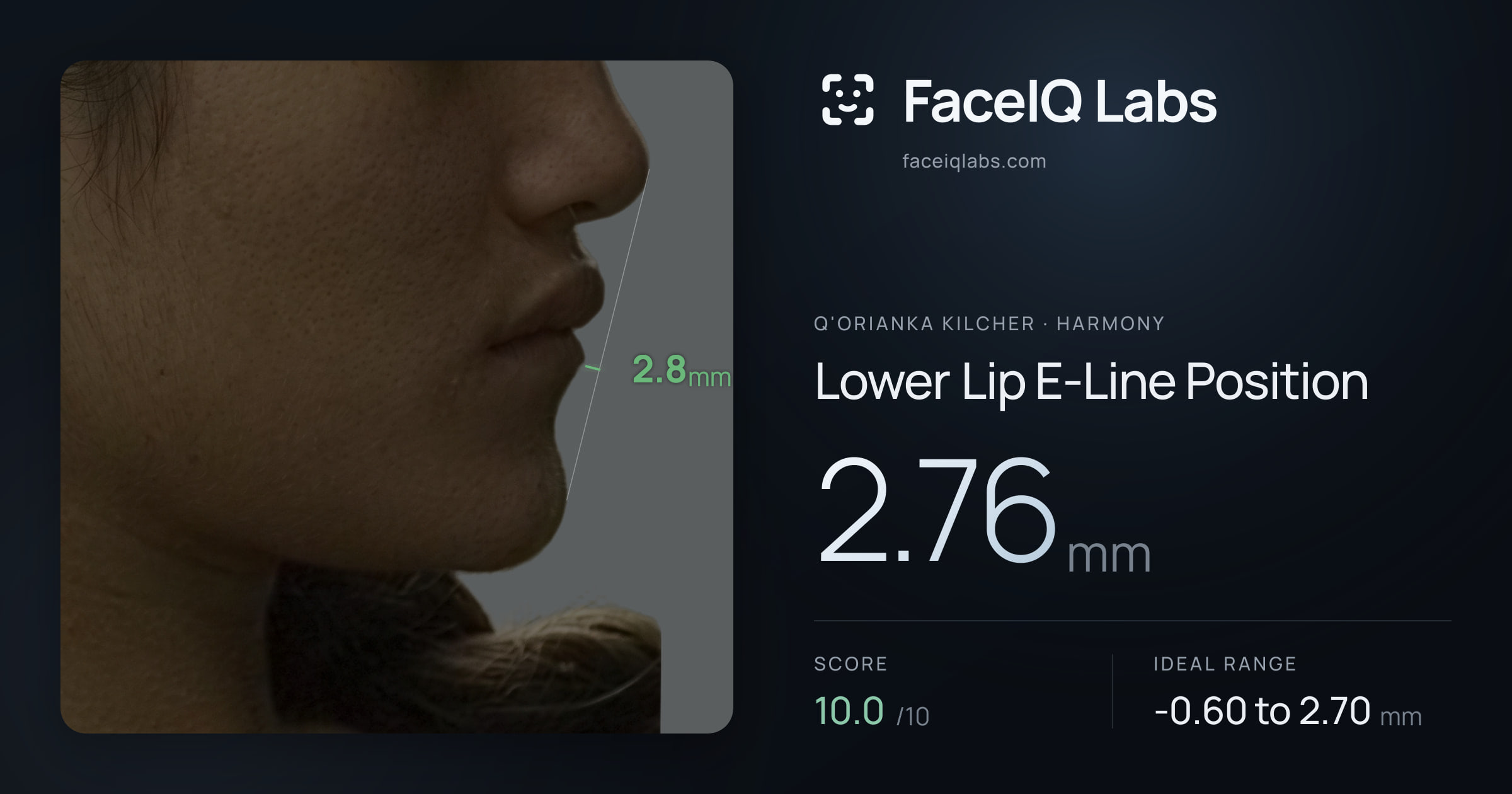 Q'orianka Kilcher Lower Lip E-Line Position: 2.76mm, drawn on the photo