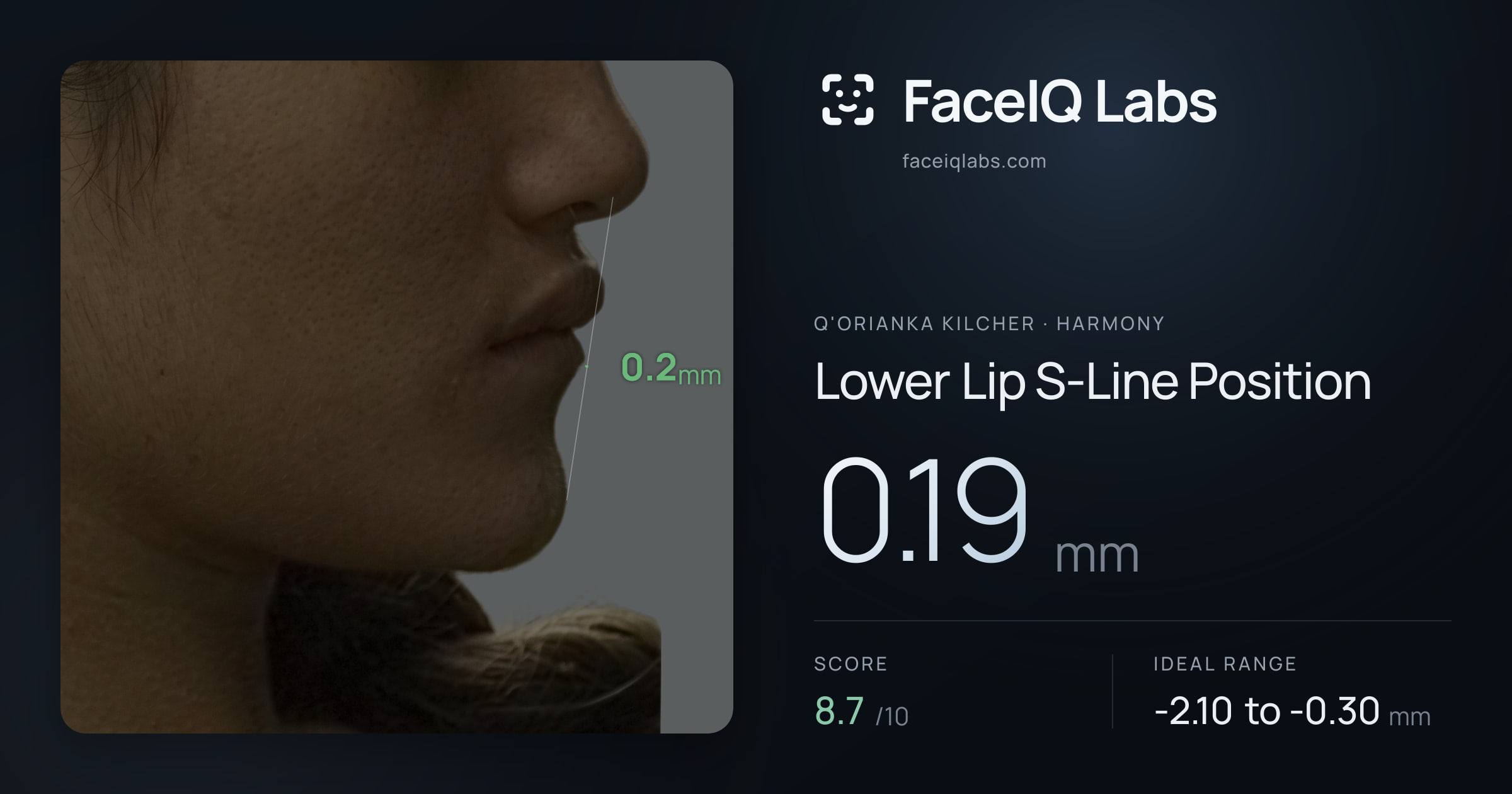 Q'orianka Kilcher Lower Lip S-Line Position: 0.19mm, drawn on the photo