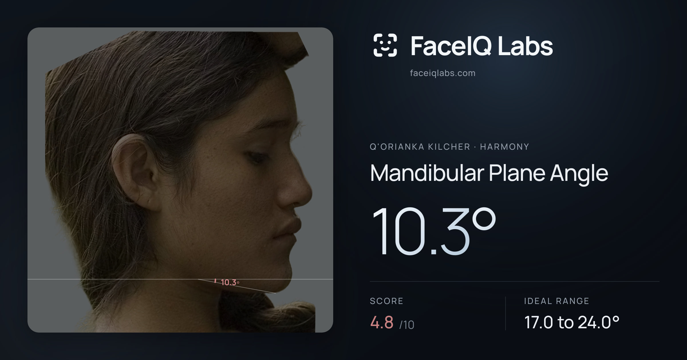 Q'orianka Kilcher Mandibular Plane Angle: 10.3°, drawn on the photo